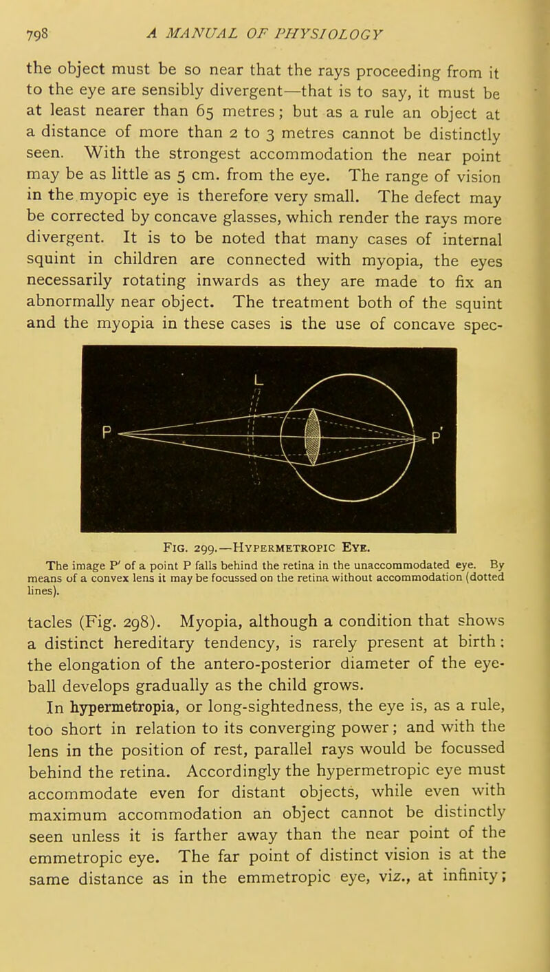 the object must be so near that the rays proceeding from it to the eye are sensibly divergent—that is to say, it must be at least nearer than 65 metres; but as a rule an object at a distance of more than 2 to 3 metres cannot be distinctly seen. With the strongest accommodation the near point may be as httle as 5 cm. from the eye. The range of vision in the myopic eye is therefore very small. The defect may be corrected by concave glasses, which render the rays more divergent. It is to be noted that many cases of internal squint in children are connected with myopia, the eyes necessarily rotating inwards as they are made to fix an abnormally near object. The treatment both of the squint and the myopia in these cases is the use of concave spec- FiG. 299.—Hypermetropic Eye. The image P' of a point P falls behind the retina in the unaccommodated eye. By means of a convex lens it may be focussed on the retina without accommodation (dotted lines). tacles (Fig. 298). Myopia, although a condition that shows a distinct hereditary tendency, is rarely present at birth; the elongation of the antero-posterior diameter of the eye- ball develops gradually as the child grows. In hypermetropia, or long-sightedness, the eye is, as a rule, too short in relation to its converging power; and with the lens in the position of rest, parallel rays would be focussed behind the retina. Accordingly the hypermetropic eye must accommodate even for distant objects, while even with maximum accommodation an object cannot be distinctly seen unless it is farther away than the near point of the emmetropic eye. The far point of distinct vision is at the same distance as in the emmetropic eye, viz., at infinity;