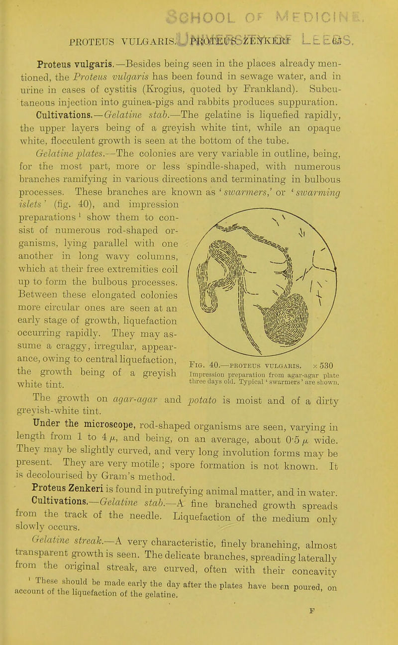 'vHOuL v.- MEDICfi PROTEUS VULGARIS. ,' priOTE0~£Si:l^<:]iiJi^ Proteus vulgaris.—Besides being seen in the places already men- tioned, the Proteus vulgaris has been found in sewage water, and in urine in cases of cystitis (Krogius, quoted by Frankland). Subcu- taneous injection into guinea-pigs and rabbits produces suppuration. Cultivations. — Gelatine stab.—The gelatine is liquefied rapidly, the upper layers being of a greyish white tint, while an opaque white, flocculent growth is seen at the bottom of the tube. Gelatine plates.—The colonies are very variable in outline, being, for the most part, more or less spindle-shaped, with numerous branches ramifying in various directions and terminating in bulbous processes. These branches are known as ' sioarmers' or ' sioarming islets ' (lig. 40), and impression prepai'ations ' show them to con- sist of numerous rod-shaped or- ganisms, lying parallel with one another in long wavy columns, which at their free extremities coil up to form the bulbous processes. Between these elongated colonies more chcular ones are seen at an early stage of growth, liquefaction occurring rapidly. They may as- sume a craggy, irregular, appear- ance, owing to central hquefaction, the growth being of a greyish white tint. The growth on agar-agar and j^otato is moist and of a dirty greyish-white tint. Under the microscope, rod-shaped organisms are seen, varying in length from 1 to 4/i, and being, on an average, about 0-5 wide. They may be slightly curved, and very long involution forms may be present. They are very motile; spore formation is not known. It is decolourised by Gram's method. Proteus Zenkeri is found in putrefying animal matter, and in water. Cultivations.—GeZa^me stab.~k fine branched growth spreads from the track of the needle. Liquefaction of the medium only slowly occurs. Gelatine streak.—A very characteristic, finely branching, almost transparent growth is seen. Thedehcate branches, spreading laterally from the original streak, are curved, often with their concavity ' n^ade early the day after the plates have been poured, account of the liquefaction of the gelatine. -PKOTEtIS VULGAKIS. X 530 Impression preparation from agar-agar plate tliree days old. Typical ' swr.rmers' are shown. on