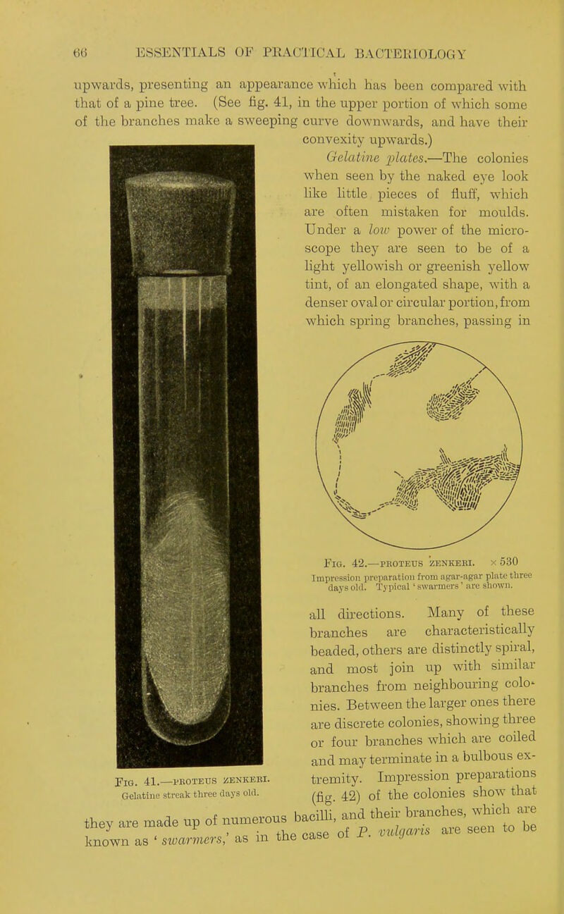 t upwards, presenting an appearance which has been compared with that of a pine tree. (See fig. 41, in the upper portion of which some of the branches make a sweeping curve downwards, and have their convexity upwards.) Gelatine plates.—Tlie colonies when seen by the naked eye look like little pieces of fluff, which are often mistaken for moulds. Under a loic power of the micro- scope they are seen to be of a light yellowish or greenish yellow tint, of an elongated shape, with a denser oval or circular portion, from which spring branches, passing in Fig. 42.—pkoteus zenkeei. x 530 Impression preparation from agar-agar plate tliree days olil. Typical ' swarmers' are shown. all directions. Many of these branches are characteristically beaded, others are distinctly spiral, and most join up with similar branches from neighbouring colo- nies. Between the larger ones there are discrete colonies, showing three or four branches which are coiled and may terminate in a bulbous ex- tremity. Impression preparations (ficr 42) of the colonies show that fey - -ae up known as ' sivarmers, as m tne cabe ui j. ■ j Fig. 41.—pkoteus iSENKEBi. Gelatine streak three days old.