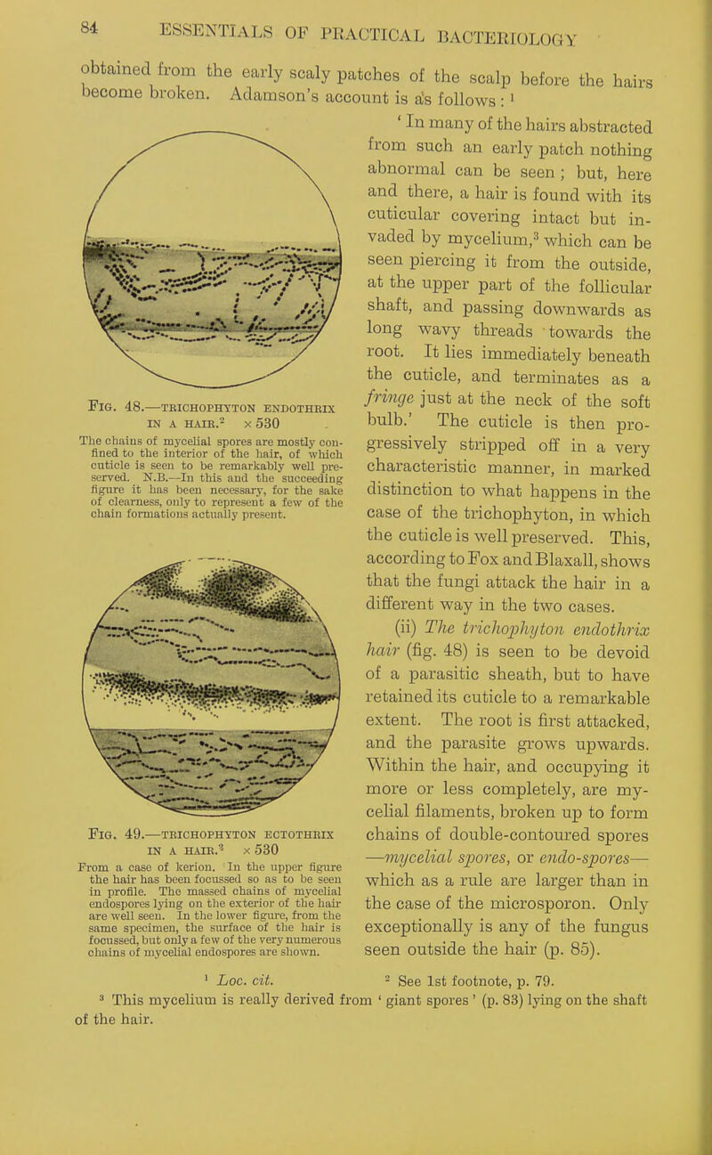 obtained from the early scaly patches of the scalp before the hairs become broken. Adamson's account is a's follows :' ' In many of the hairs abstracted from such an early patch nothing abnormal can be seen ; but, here and there, a hair is found with its cuticular covering intact but in- vaded by mycelium,''! which can be seen piercing it from the outside, at the upper part of the follicular shaft, and passing downwards as long wavy threads towards the root. It lies immediately beneath the cuticle, and terminates as a fringe just at the neck of the soft bulb.' The cuticle is then pro- gressively stripped off in a very characteristic manner, in marked distinction to what happens in the case of the trichophyton, in which the cuticle is well preserved. This, according to Fox and Blaxall, shows that the fungi attack the hair in a different way in the two cases. (ii) The trichophyton endothrix hair (fig. 48) is seen to be devoid of a parasitic sheath, but to have retained its cuticle to a remarkable extent. The root is first attacked, and the parasite gi'ows upwards. Within the hair, and occupying it more or less completely, are my- cehal filaments, broken up to form chains of double-contoured spores —mycelial spores, or endo-spores— which as a rule are larger than in the case of the microsporon. Only exceptionally is any of the fungus seen outside the hair (p. 85). Fig. 48.—tbichophyton endothrix in a haik.^ x 530 The chaius of mycelial spores are mostly con- fined to the interior of the hair, of which cuticle is seen to be remarkably well pre- served. ^ N.B.—In this and the succeeding figure it has been necessary, for the sake of clearness, only to represent a few of the chain formations actually present. Fig. 49.—tbichophyton ectotheix in a haie.'^ x 530 From a case of kerion. In the upper figure the hair has been fooussed so as to be seen in profile. The massed chains of mycelial endospores lying on the exterior of the hair are well seen. In the lower figiu-e, fi-om the same specimen, the surface of the hair is focussed, but only a few of the very numerous chains of mycelial endospores are shown. Loc. cit. See 1st footnote, p. 79. ^ This mycelium is really derived from ' giant spores ' (p. 83) lying on the shaft of the hair.