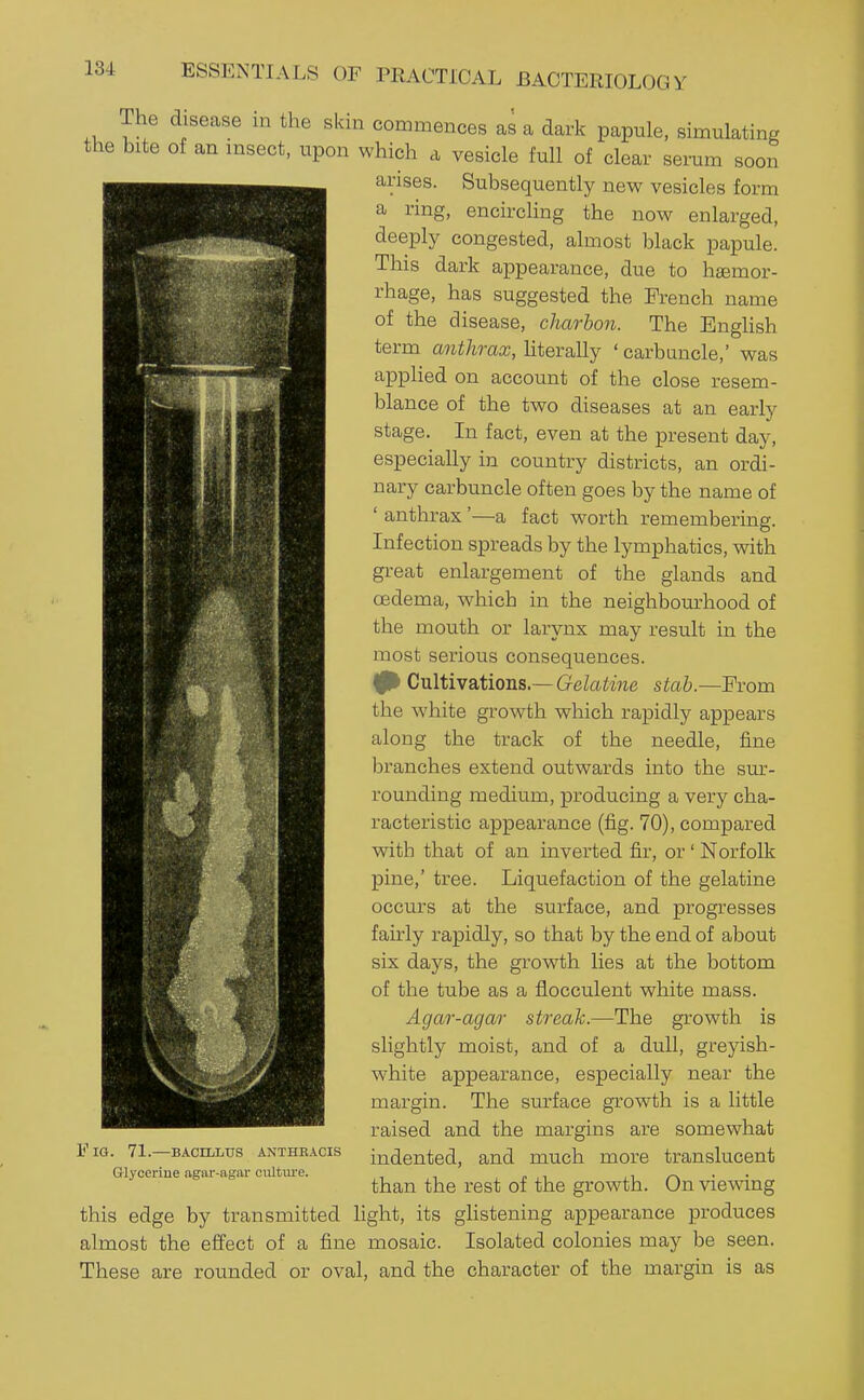 The disease in the skin commences as a dark papule, simulating the bite of an insect, upon which a vesicle full of clear senim soon arises. Subsequently new vesicles form a ring, encircling the now enlarged, deeply congested, almost black papule. This dark appearance, due to haemor- rhage, has suggested the French name of the disease, charbon. The EngUsh term anthrax, hterally ' carbuncle,' was applied on account of the close resem- blance of the two diseases at an early stage. In fact, even at the present day, especially in country districts, an ordi- nary carbuncle often goes by the name of ' anthrax '—a fact worth remembering. Infection spreads by the lymphatics, with great enlargement of the glands and oedema, which in the neighbom-hood of the mouth or larynx may result in the most serious consequences. 0^ Cultivations.—GeZa^me stab.—Prom the white growth which rapidly appears along the track of the needle, fine branches extend outwards into the sm-- rounding medium, producing a very cha- racteristic appearance (fig. 70), compared with that of an inverted fir, or' Norfolk pine,' tree. Liquefaction of the gelatine occurs at the surface, and progresses fairly rapidly, so that by the end of about six days, the growth lies at the bottom of the tube as a flocculent white mass. Agar-agar streak.—The growth is slightly moist, and of a dull, greyish- white appearance, especially near the margin. The surface growth is a little raised and the margins are somewhat indented, and much more translucent than the rest of the growth. On viewing this edge by transmitted hght, its ghstening appearance produces almost the effect of a fine mosaic. Isolated colonies may be seen. These are rounded or oval, and the character of the margin is as V IG. 71.—BACILLUS ANTHBACIS Glycerine agiir-iigai- culture.