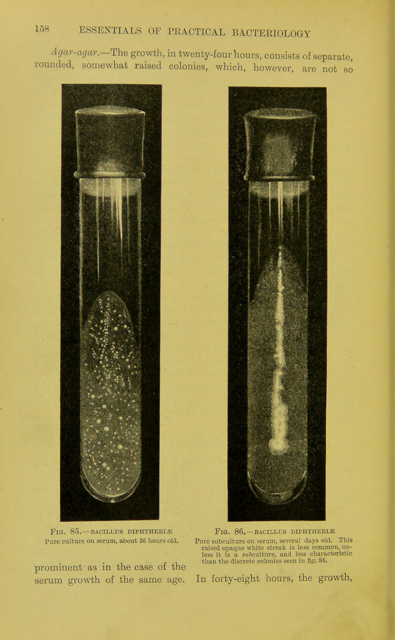 Agar-agar.—The growth, in twenty-four liours, consists of separate, rounded, somewhat raised colonies, which, however, are not so Fig. 85.—BACiLLtrs diphthebi^ Fig. 86.—bacillus DiPHTHERiiE Pure culture on serum, about 36 hours old. Pure subculture ou serum, several days old. Tbis raised opaque white streak is less common,^ un- less it is a iitftculture, and less characteristic , . , than the discrete colonies seen in fig. 86. prominent as m the case oi the serum growth of the same age. In forty-eight hours, the growth,