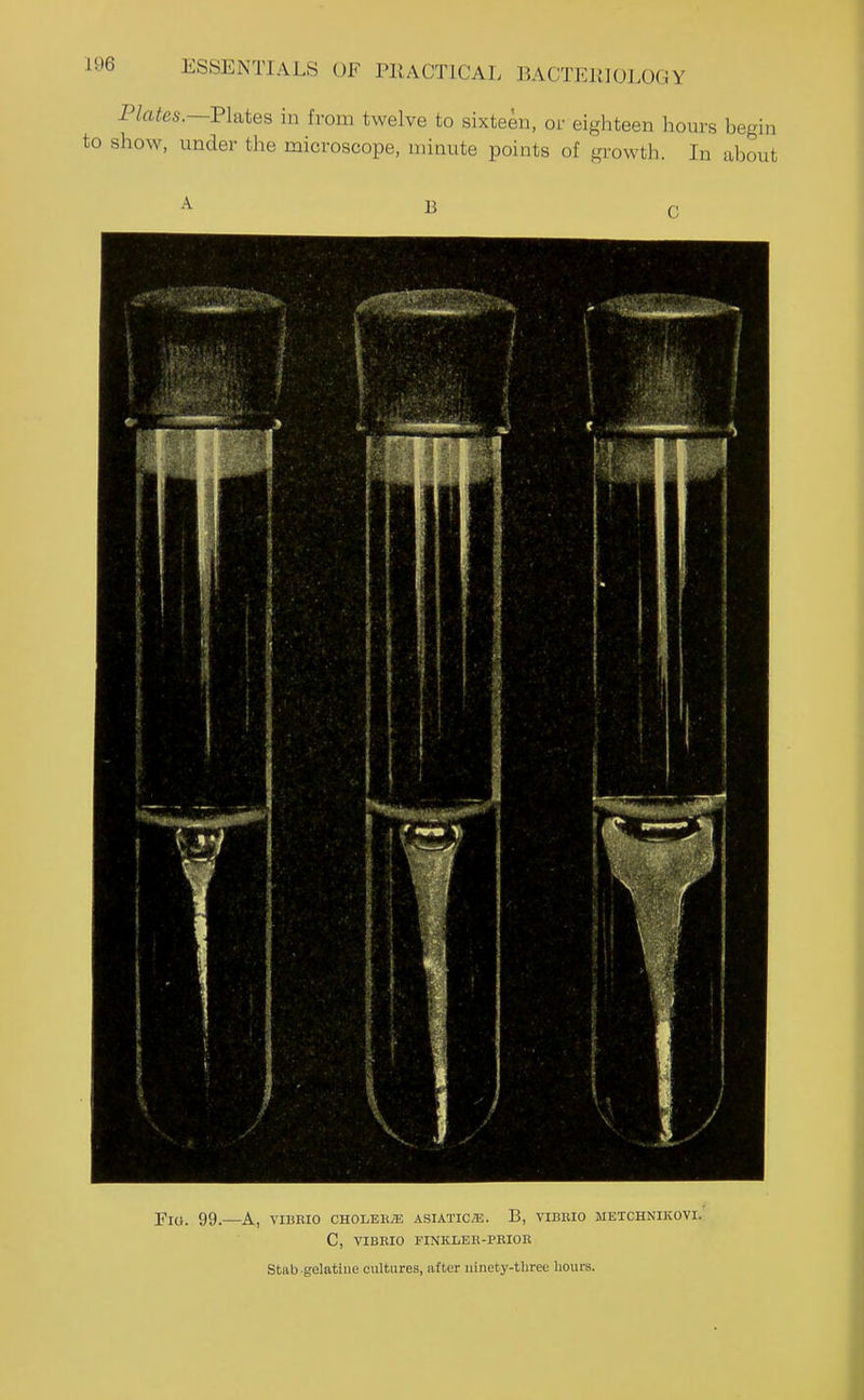 PZa^es.—Plates in from twelve to sixteen, or eighteen hours begin to show, under the microscope, minute points of growth. In about B FlO. 99. A, VIBRIO CHOLEK^E ASIATICE. B, VIBRIO METCHNIKOVI. C, VIBRIO riNKLEH-PRIOR