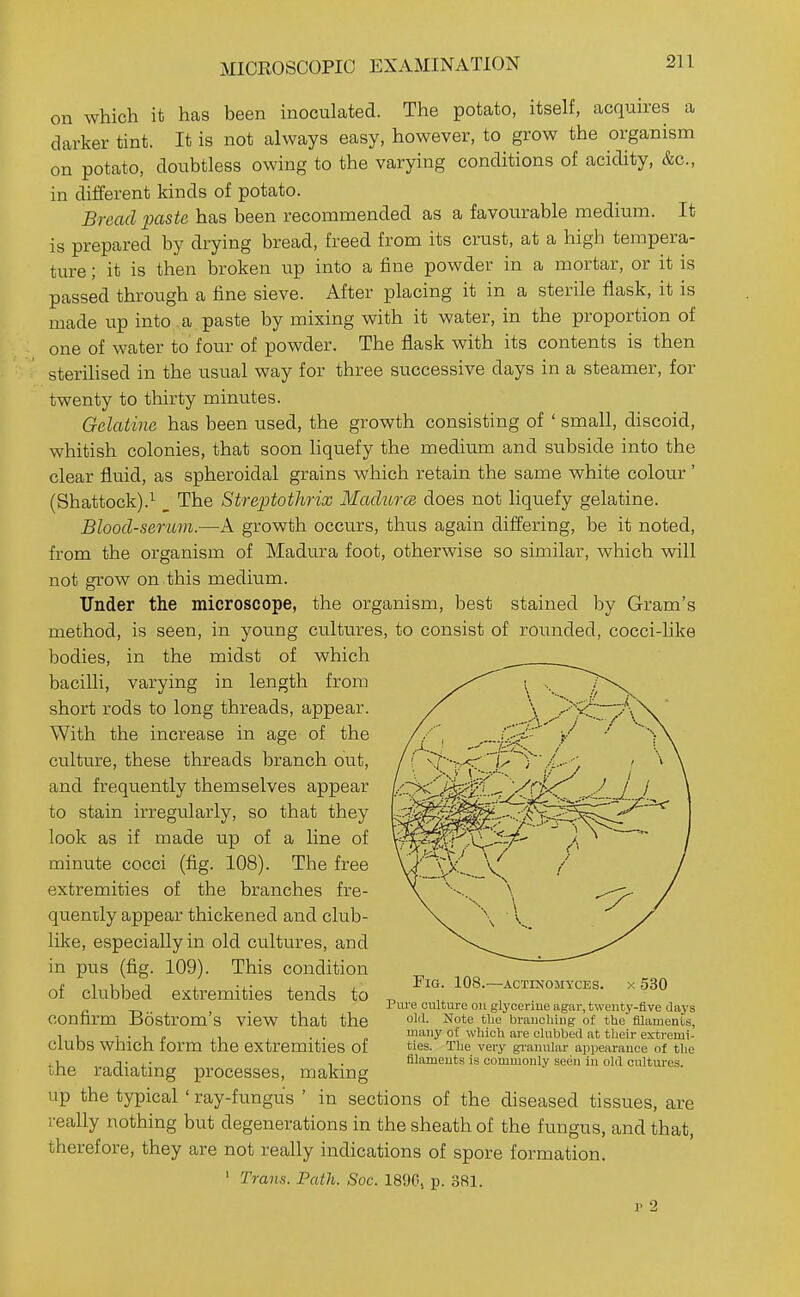 MICROSCOPIC EXAMINATION It on which it has been inoculated. The potato, itself, acquires a darker tint. It is not always easy, however, to grow the organism on potato, doubtless owing to the varying conditions of acidity, &c., in different kinds of potato. Bread paste has been recommended as a favourable medium is prepared by drying bread, freed from its crust, at a high tempera- ture ; it is then broken up into a fine powder in a mortar, or it is passed through a fine sieve. After placing it in a sterile flask, it is made up into a paste by mixing with it water, in the proportion of one of water to four of powder. The flask with its contents is then steriHsed in the usual way for three successive days in a steamer, for twenty to thirty minutes. Gelatine has been used, the growth consisting of ' small, discoid, whitish colonies, that soon liqu.efy the medium and subside into the clear fluid, as spheroidal grains which retain the same white colour' (Shattock).^ _ The Streptothrix Machcrm does not liquefy gelatine. Blood-sermn.—A growth occurs, thus again differing, be it noted, from the organism of Madura foot, otherwise so similar, which will not gi'ow on this medium. Uader the microscope, the organism, best stained by Gram's method, is seen, in young cultures, to consist of rounded, cocci-like bodies, in the midst of which bacilli, varying in length from short rods to long threads, appear. With the increase in age of the culture, these threads branch out, and frequently themselves appear to stain irregularly, so that they look as if made up of a line of minute cocci (fig. 108). The free extremities of the branches fre- quenily appear thickened and club- like, especially in old cultures, and in pus (fig. 109). This condition of clubbed extremities tends to confirm Bostrom's view that the clubs which form the extremities of the radiating processes, making up the typical ' ray-fungus ' in sections of the diseased tissiies, are really nothing but degenerations in the sheath of the fungus, and that, therefore, they are not really indications of spore formation. ' Trans. Path. Soc. 1890, p. 381. r 2 Fig. 108.—Actinomyces, x 530 Pure culture on glycerine agar, twenty-five clays olil. Note the branching of the filaments, many of which are clubbed at their extremi- ties. The very giuuular appearance of the filaments is commonly seen in old cultures.