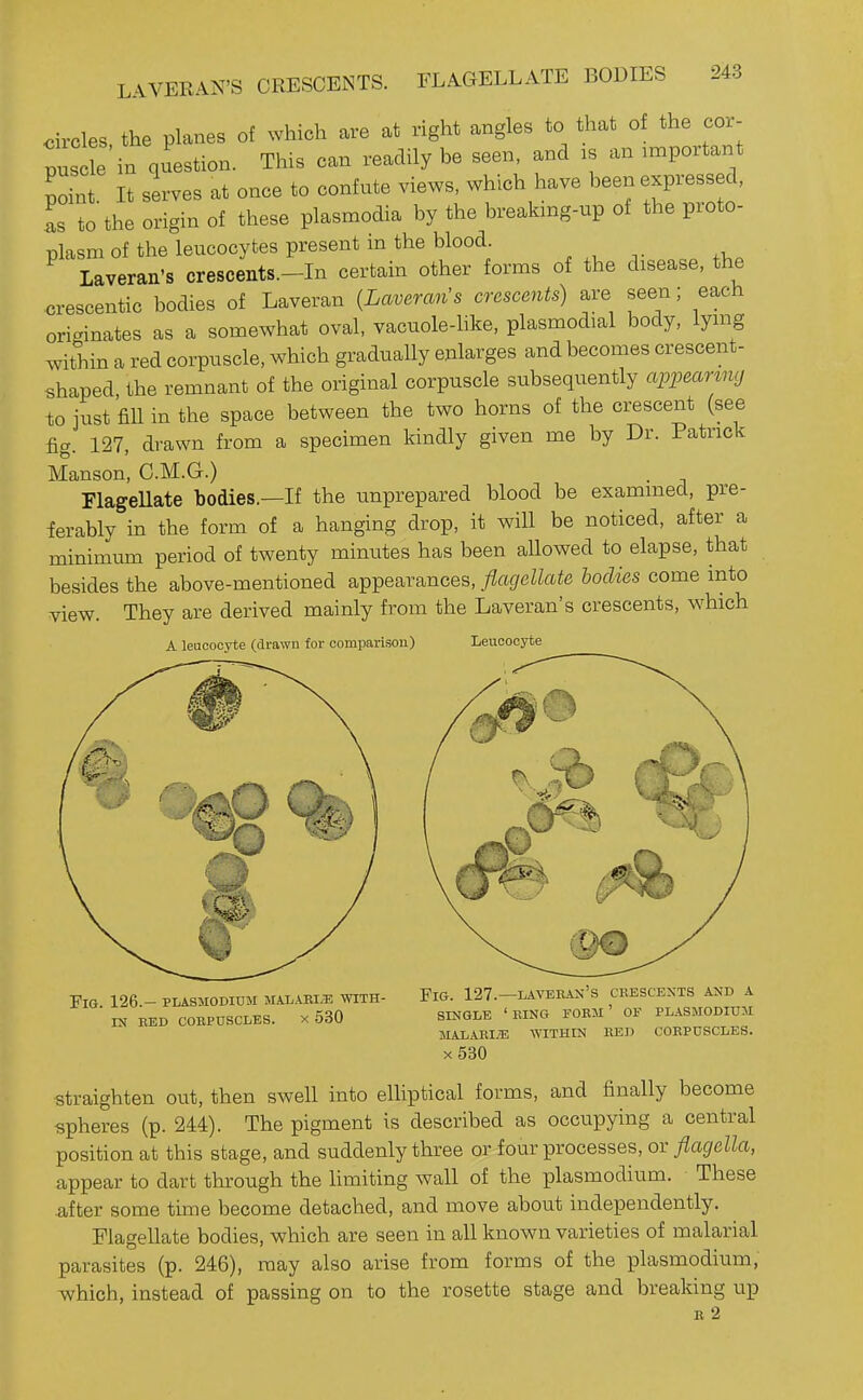 circles, the planes of which are at right angles to that of the cor- pusc e in question. This can readily be seen, and :s an important pit. It serves at once to confute views, which have been expressed, L to the origin of these plasmodia by the breakmg-up of the proto- plasm of the leucocytes present in the blood Laveran's crescents.-In certain other forms of the disease, the crescentic bodies of Laveran {Laveran^s crescents) are seen; each oric^inates as a somewhat oval, vacuole-hke, plasmodial body, lymg within a red corpuscle, which gradually enlarges and becomes crescent- shaped the remnant of the original corpuscle subsequently appearmg to just fiU in the space between the two horns of the crescent (see fig. 127, drawn from a specimen kindly given me by Dr. Patrick Manson, O.M.G.) . FlageUate bodies.—If the unprepared blood be examined, pre- ferably in the form of a hanging drop, it will be noticed, after a minimum period of twenty minutes has been aUowed to elapse, that besides the above-mentioned appearances, flagellate bodies come into view. They are derived mainly from the Laveran's crescents, which A leucocyte (drawn for comparison) Leucocyte Fig. 126.- Plasmodium malabi,i5 with- in RED CORPUSCLES. X 630 Fig. 127.—laveran's chbscexts and a SINGLE 'ring FOEM' OF PLASMODIUM MALARIiE WITHIN EED COEPUSCLES. x530 Straighten out, then swell into elliptical forms, and finally become spheres (p. 244). The pigment is described as occupying a central position at this stage, and suddenly three or four processes, or flagella, appear to dart through the limiting wall of the plasmodium. These after some time become detached, and move about independently. Flagellate bodies, which are seen in all known varieties of malarial parasites (p. 246), may also arise from forms of the plasmodium, which, instead of passing on to the rosette stage and breaking up E 2