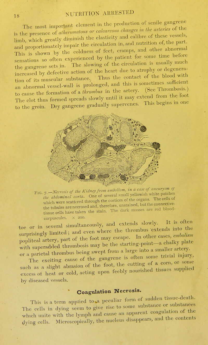 The most important element in the P-d-tion of senile gangre^^ is the presence of alkero^atous or calcareous clu.gc. .. ''- ^^^-^^^^^^^ limb, which greatly diminish the elasticity and cahbre of *-e vesse s and proportionately impair the circulation m,and ^^ntio of, the p^^^^ This is shown by the coldness of feet, cramps, and other abnormal ^^sa«ons si often experienced by the patient for some t.me before the tngrene sets in. The slowing of the circulation ;s usually mud. ncreled by defective action of the heart due to atrophy or degene.a- tn o L muscular substance, Thus the contact of the blood w.tl ^rabnormal vessel-wall- is prolonged, and this is  to cause the formation of . ihro^nbus in the artery. ^InomW The clot thus formed spreads slowly until it may extend fiom the foot to the groin. Dry gangrene gradually supervenes. This begms m one K,P 7 -Necrosis of the Kidney from embolism, tn a case of aneurysm oj m ZJaorta. One of several small yellowish wh.te pa ches vhich were scattered through the cortices of the organs. The cells of Te s are necrosed anl therefore, ttnstained. but the connecUve- tissue cells have taken the stain. The dark masses are red blood- corpuscules. x 200. :f «<^or... escape. In o*e. c..e. \L superadded tl..or„bosis may be the -^^'^'^^-^''J;^^^^^:'' or a parietal thrombus being swept from a large mto » The exciting cause of the gangrene is often some '^^ such a, a sli<.ht abrasion of the foot, the cuttn,g of a coin, oi some exces; o. W, or cold, acting upon feebly nourished tissues supphed by diseased vessels. * Coagulation Necrosis. 1- ,. nf sudden tissue-death. This is a term applied to^a pecuhar toim ot sucicien The cells in dying Uem to give rise to some substance - substances wh.ch unite with The lymph and cause an apparent coagulation of the dying cells. Microscopically, the nucleus disappears, and the contents