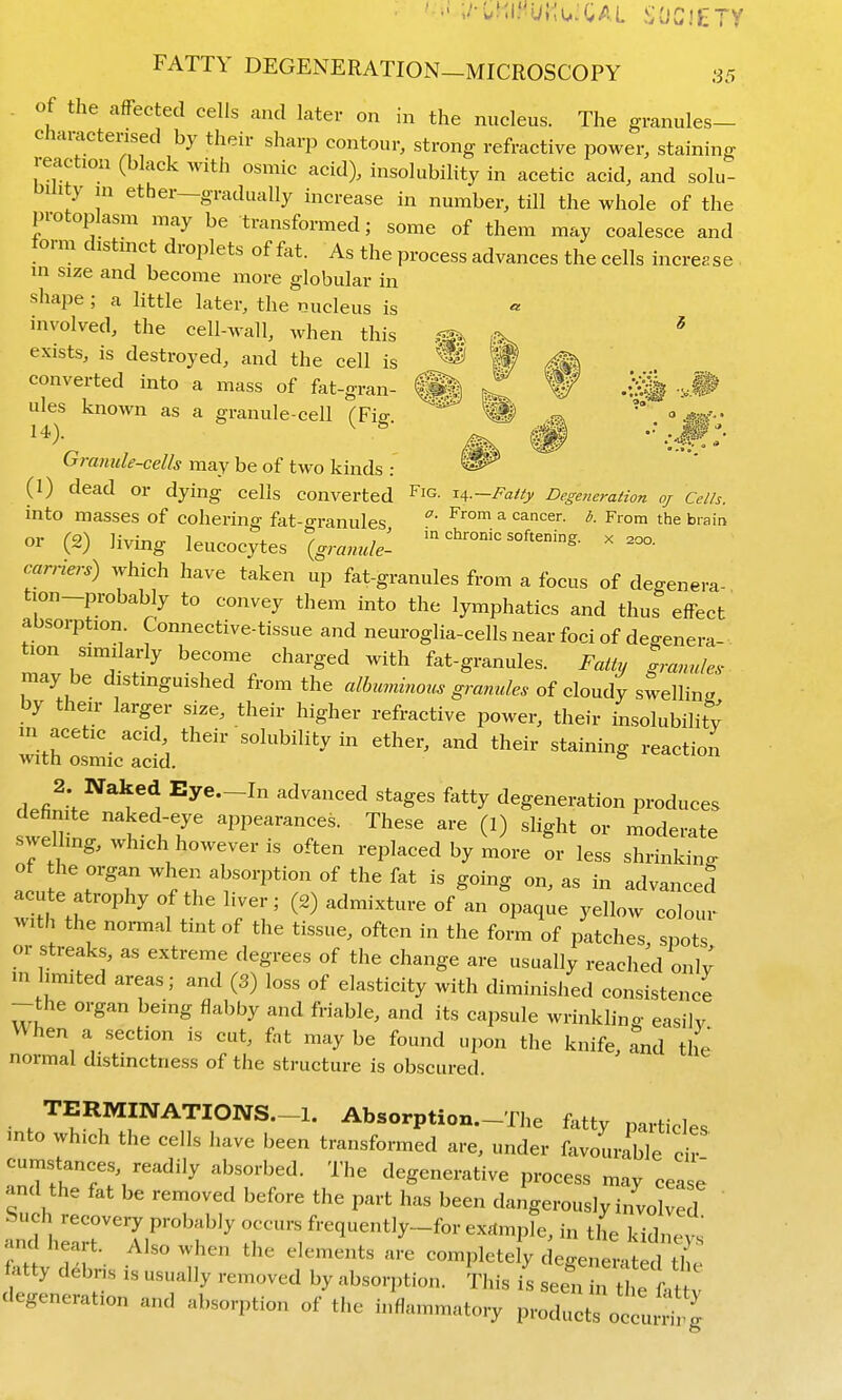 . of the affected cells and later on in the nucleus. The granules- charactensed by their sharp contour, strong refractive power, staining reaction (black with osmic acid), insolubihty in acetic acid, and solu- y in ether-gradually increase in number, till the whole of the protoplasm may be transformed; some of them may coalesce and form distinct droplets of fet. As the process advances the cells increase in size and become more globular in shape ; a little later, the nucleus is involved, the cell-wall, when this .<^. * exists, is destroyed, and the cell is ^ If ^ converted into a mass of fat-gran- ® feT W -v.P ules known as a granule-cell (Fiff. ^ m;- 14). V'' ^ ^ •'.■■Wt- Gramele-cells may be of two kinds : (1) dead or dying cells converted ^ig. 14.—FaUy Degeneration oj Cells. into masses of cohering fat-o-ranules °' a cancer. ^. From the brain or (2) living leucocytes \granule- '^'^'--^ ^^--g- x -o. carriers) which have taken up fat-granules from a focus of degenera- tion-probably to convey them into the lymphatics and thus effect absorption Connective-tissue and neuroglia-cells near foci of degenera- tion similarly become charged with fat-granules. Fatty gramdes may be distinguished from the alhcmmoiis gramdes of cloudy st^Win^ by their larger size, their higher refractive power, their insolubility in acetic acid their solubility in ether, and their staining reaction with n<5rmn ar^iA civ-nun rl.fi ; ^ . Eye—In advanced stages fatty degeneration produces sw!n!n' rr PP^^'^^«^- These are (l) slight or moderate swelling, which however is often replaced by more or less shrinkino- of he organ when absorption of the fat is going on, as in advanced acute atrophy of the liver; (2) admixture of an opaque yellow colour with the normal tint of the tissue, often in the form of patches, spots or streaks, as extreme degrees of the change are usually reached only' in limited areas; and (3) loss of elasticity with diminisJied consistence -the organ being flabby and friable, and its capsule wrinkling easily When a section is cut, fat may be found upon the knife, and the normal distinctness of the structure is obscured. TERMmATIONS.-l. Absorption.-The fatty particles into which the cells have been transformed are, under favourable c r cumstances, readily absorbed. The degenerative process may cease' and the fat be removed before the part has been dangerously inyo vTd and lieait. Also when the elements are completely deffener.tprl tl, fatty debris is usually removed by absorption, ^^his is seeTin t e k^^^ degeneration and absorption of the inflammatory products occunil