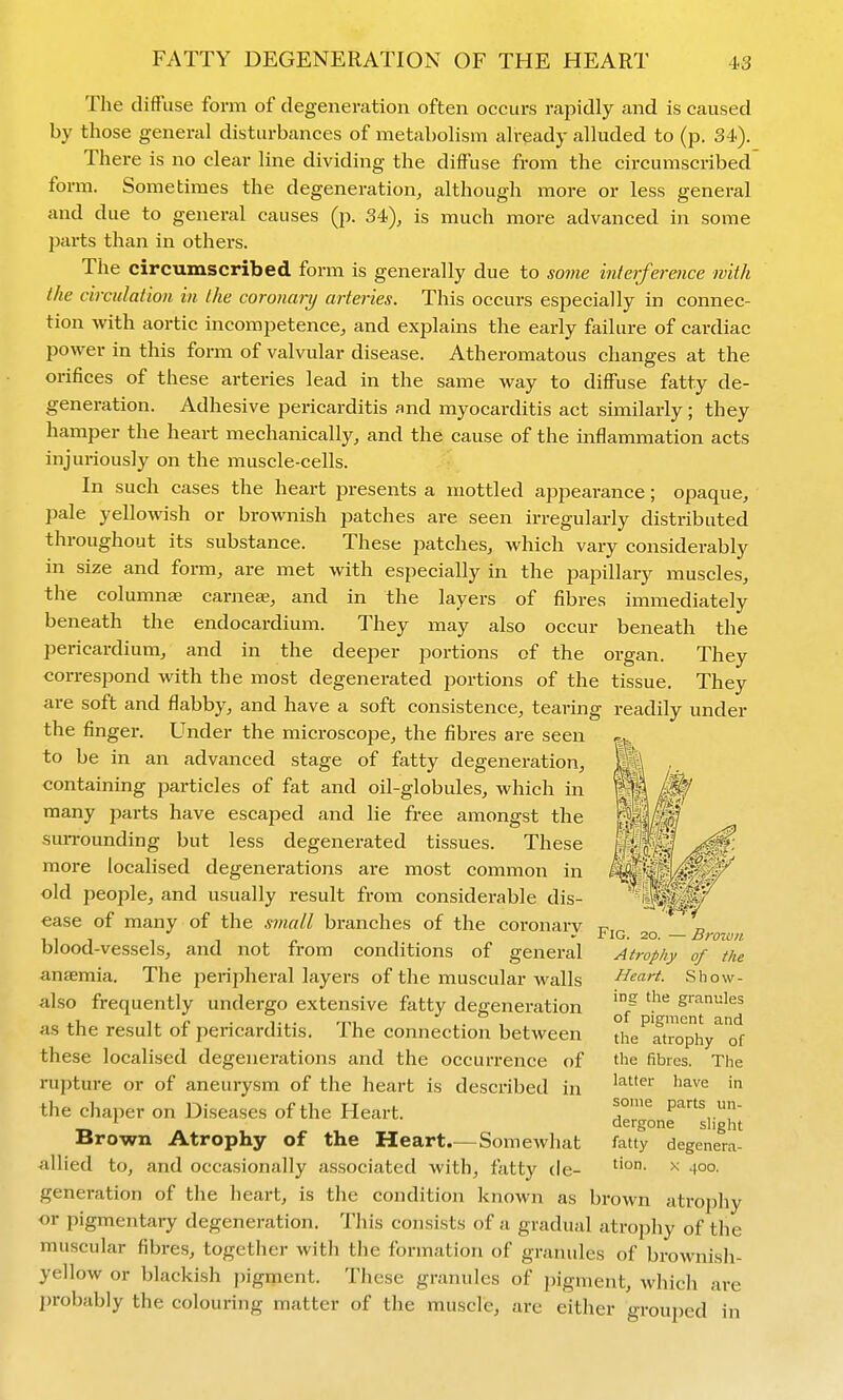 The diffuse form of degeneration often occurs rapidly and is caused by those general disturbances of metabolism already alluded to (p. 34). There is no clear line dividing the diffuse from the circumscribed form. Sometimes the degeneration, although more or less general and due to general causes (p. 34), is much more advanced in some parts than in others. The circumscribed form is generally due to some interference with the circulation in the coronary arteries. This occurs especially in connec- tion with aortic incompetence, and explains the early failure of cardiac power in this form of valvular disease. Atheromatous changes at the orifices of these arteries lead in the same way to diffuse fatty de- generation. Adhesive pericarditis and myocarditis act similarly; they hamper the heart mechanically, and the cause of the mflammation acts injuriously on the muscle-cells. In such cases the heart presents a mottled appearance; opaque, pale yellowish or brownish patches are seen irregularly distributed throughout its substance. These patches, which vary considerably in size and form, are met with especially in the papillary muscles, the columns carnea?, and in the layers of fibres immediately beneath the endocardium. They may also occur beneath the pericardium, and in the deeper portions of the organ. They correspond with the most degenerated portions of the tissue. They are soft and flabby, and have a soft consistence, tearing readily under the finger. Under the microscope, the fibres are seen to be in an advanced stage of fatty degeneration, containing particles of fat and oil-globules, which in many parts have escaped and lie free amongst the surrounding but less degenerated tissues. These more localised degenerations are most common in old people, and usually result from considerable dis- ease of many of the small branches of the coronary blood-vessels, and not from conditions of general antemia. The peripheral layers of the muscular walls also frequently undergo extensive fatty degeneration as the result of pericarditis. The connection between these localised degenerations and the occurrence of rupture or of aneurysm of the heart is described in the chaper on Diseases of the Heart. Brown Atrophy of the Heart.—Somewhat allied to, and occasionally associated with, fatty de- generation of the heart, is the condition known as brown atrophy or pigmentary degeneration. This consists of a gradual atrophy of the muscular fibres, together with the formation of granules of brownish- yellow or blackish pigment. These granules of pigment, which are probably the colouring matter of the muscle, are either grouped Fig. 2o. — Brnun Atrophy of the Heart. Show- ing the granules of pigment and the atrophy of the fibres. The latter have in some parts un- dergone sHght fatty degenera- tion. X 400.