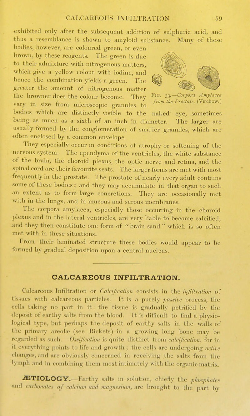 Fig. 33.—Corpora Amylacea from the Prostate. (Virchow.) exhibited only after the subsequent addition of sulphuric acid, and thus a resemblance is shown to amyloid substance. Many of these bodies, however, are coloured green, or even brown, by these reagents. The green is due to their admixture with nitrogenous matters, which give a yellow colour with iodine, and hence the combination yields a green. The ^■reater the amount of nitrogenous matter the browner does the colour become. They vary in size from microscopic granules to bodies which are distinctly visible to the naked eye, sometimes being as much as a sixth of an inch in diameter. The larger are usually formed by the conglomeration of smaller granules, which are ■often enclosed by a common envelope. They especially occur in conditions of atrophy or softening of the nervous system. The ependyma of the ventricles, the white substance or the brain, the choroid plexus, the optic nerve and retina, and the spinal cord are their favourite seats. The larger forms are met with most frequently in the prostate. The prostate of nearly every adult contains some of these bodies ; and they may accumulate in that organ to such an extent as to form large concretions. They are occasionally met with in the lungs, and in mucous and serous membranes. The corpora amylacea, especially those occurring in the choroid plexus and in the lateral ventricles, are very liable to become calcified, •and they then constitute one form of brain sand which is so often met with in these situations. From their laminated structure these bodies would appear to be formed by gradual deposition upon a central nucleus. CALCAREOUS INFILTRATION. Calcareous Infiltration or Calcification consists in the infiltraiioii of tissues with calcareous particles. It is a purely paxdve process, the cells taking no part in it: the tissue is gradually petrified by the deposit of earthy salts from the blood. It is difficult to find a jjhysio- logical type, but perhaps the deposit of earthy salts in the walls of the primary areolae (see Rickets) in a growing long bone may be regarded as such. Osd/icalioii is quite distinct from calcijication, for in it everything points to life and growth ; the cells are undergoing active changes, and are obviously concerned in receiving the salts from the lymph and in combining them most intimately with the organic matrix. ETIOLOGY.—Earthy .salts in solution, chiefly the phospliates and carbonates of calcimn and magnesium, are brought to the part by