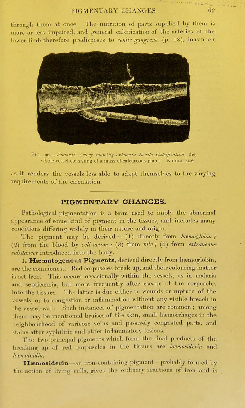 through them at once. The nutrition of parts supplied by them is more or less impaired, and general calcification of the arteries of the lower limb therefore predisposes to senile gangrene (p. 18), inasmuch Fig. 36.—Femoral Artery s/wiuing extensive Senile Calcification, the whole vessel consisting of a mass of calcareous plates. Natural size. as it renders the vessels less able to adapt themselves to the varying requirements of the circulation. PIGMENTARY CHANGES. Pathological pigmentation is a term used to imply the abnormal ajjpearance of some kind of pigment in the tissues, and includes many conditions differing widely in their nature and origin. The pigment may be derived:—(1) directly from hcemoghhin ;^ (2) from the blood by cell-action ; (3) from bile; (4) from extraneoiift xiibstances introduced into the body. 1. Haematogenous Pigments, derived directly from hfemoglobin, are the commonest. Red corpuscles break up, and their colouring matter is set free. This occurs occasionally within the vessels, as in malaria and septicaemia, but more frequently after escape of the corpuscles into the tissues. The latter is due either to wounds or rupture of the vessels, or to congestion or inflammation without any visible breach in the vessel-wall. Such instances of pigmentation are common ; among them may be mentioned bruises of the skin, small htemorrhages in the neighbourhood of varicose veins and jjassively congested parts, and stains after syphilitic and other inflammatory lesions. The two principal pigments which form the final products of the breaking up of red corpuscles in the tissues are /uemosiderin and liaEmaloidhi. Hsemosiderin—an iron-containing pigment—probably forvned by the action of living cells, gives the ordinary reactions of iron and is