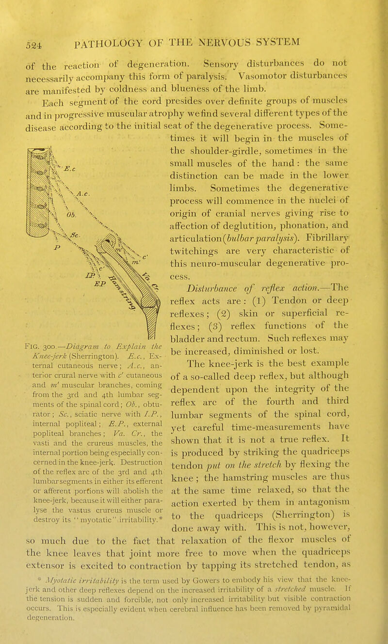 of the reaction of degeneration. Sensory disturbances do not necessarily accompany this form of paralysis. Vasomotor disturbances are manifested by coldness and blueness of the limb. Each segment of the cord presides over definite groups of muscles and in j)rogressive muscular atrophy we find several different types of the disease according to the initial seat of the degenerative process. Some- times it will begin in the muscles of the shouldei'-girdle, sometimes in the small muscles of the hand: the same distinction can be made in the lower limbs. Sometimes the degenerative jDrocess will commence in the nuclei of origin of cranial nerves giving rise to affection of deglutition, phonation, and avticula.tion(bidbarparali/sis). Fibrillary twitchings are very characteristic of this neuro-muscular degenerative pro- cess. Disturbance of rejlex action.—The reflex acts are: (l) Tendon or deep reflexes; (2) skin or superficial re- flexes ; (3) reflex functions of the bladder and rectum. Such reflexes may be increased, diminished or lost. The knee-jerk is the best examjile of a so-called deep reflex, but although dependent upon the integrity of the reflex arc of the fourth and third lumbar segments of the spinal cord, yet careful time-measurements have shown that it is not a true reflex. It is produced by striking the quadriceps tendon put on the stretch by flexing the knee ; the hamstring muscles are thus at the same time relaxed, so that the action exerted by them in antagonism to the quadriceps (Sherrington) is done away with. This is not, however, so much due to the fact that relaxation of the flexor muscles of the knee leaves that joint more free to move when the quadriceps extensor is excited to contraction by tapping its stretched tendon, as «' Myotatic irritability is the lerm used by Gowers to embody his view that the knee- jerk and other deep reflexes depend on the increased irritabihty of a stretched muscle. If the tension is sudden and forcible, not only increased irritability but visible contraction occurs. This is especially evident when cerebral influence has been removed by pyraciidal degeneration. Fig. 300.—Diagram to Explain the A'«e6'j?'i!;r/J (Sherrington). E.c, Ex- ternal cutaneous nerve; A.c, an- terior crural nerve with c' cutaneous and m' muscular branches, coming from the 3rd and 4th lumbar seg- ments of the spinal cord; Ob., obtu- rator; Sc., sciatic nerve with LP., internal popliteal; E.P., external popliteal branches; Va. Cr., the vasti and the crureus muscles, the internal portion being especially con- cerned in the knee-jerk. Destruction of the reflex arc of the 3rd and 4th lunibarsegments in either its efferent or afferent portions will abolish the knee-jerk, because it will either para- lyse the vastus crureus muscle or destroy its myotatic irritabilit}'.*