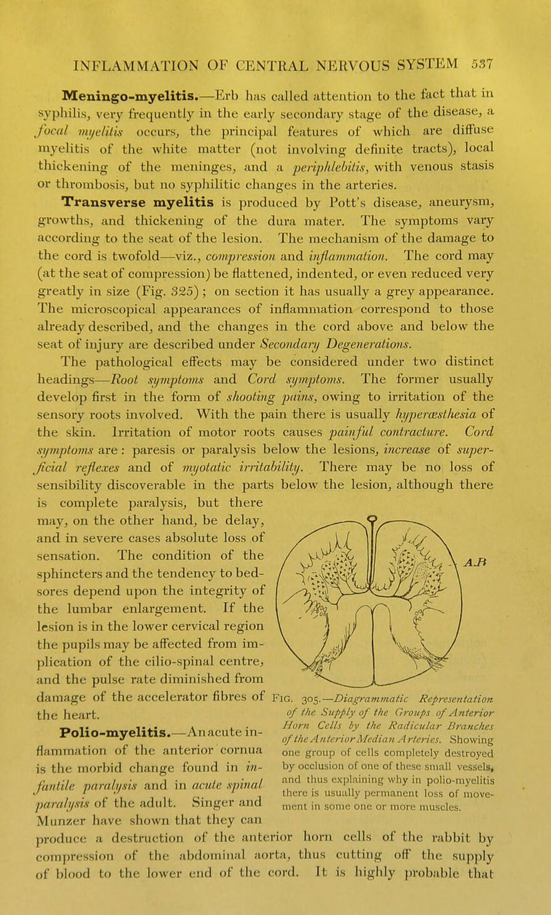Meningo-myelitis.—Erb has called attention to the fact that in syphilis, very frequently in the early secondary stage of the disease, a focal mijelilis occurs, the principal features of which are diffuse myelitis of the white matter (not involving definite tracts), local thickening of the meninges, and a penphlehilu-, with venous stasis or thrombosis, but no syphilitic changes in the arteries. Transverse myelitis is produced by Pott's disease, aneurysm, growths, and thickening of the dura mater. The symptoms vary according to the seat of the lesion. The mechanism of the damage to the cord is twofold—viz., compression and injiammation. The cord may (at the seat of compression) be flattened, indented, or even reduced very greatly in size (Fig. 325) ; on section it has usually a grey appearance. The microscopical appearances of inflammation correspond to those already described, and the changes in the cord above and below the seat of inj ury are described under Secondarij Degenerations. The pathological effects may be considered under two distinct headings—Root symptoms and Cord symptoms. The former usually develop first in the form of shooting jj/dns, owing to irritation of the sensory roots involved. With the pain there is usually hypercesthesia of the skin. Irritation of motor roots causes painful conti-acture. Cord symptoms are: paresis or paralysis below the lesions, increase of super- ficial reflexes and of myotalic irritability. There may be no loss of sensibility discoverable in the parts below the lesion, although there is complete paralysis, but there may, on the other hand, be delay, and in severe cases absolute loss of sensation. The condition of the sphincters and the tendency to bed- sores depend upon the integrity of the lumbar enlargement. If the lesion is in the lower cervical region the pupils may be affected from im- plication of the cilio-spinal centre, and the pulse rate diminished from damage of the accelerator fibres of Fig. y>s—Diagrammatic Rcprcsetitation the heart. Polio-myelitis.—Anacute in- flammation of the anterior cornua is the morbid change found in in- fantile paralysis and in acute .ipinal paralysis of the adult. Singer and of the Supply of the Groups of A nterior Horn Cells by the Radicular Branches of the AnteriorMediaii. Arteries. Showing one group of cells completely destroyed by occlusion of one of these small vessels, and thus explaining why in polio-myelitis there is usually permanent loss of move- ment in some one or more nuiscles. Munzer have shown that they can produce a destruction of the anterior horn cells of the rabbit by compression of the abdominal aorta, thus cutting ofl' the supply of blood to the lower end of the cord. It is highly })robable that