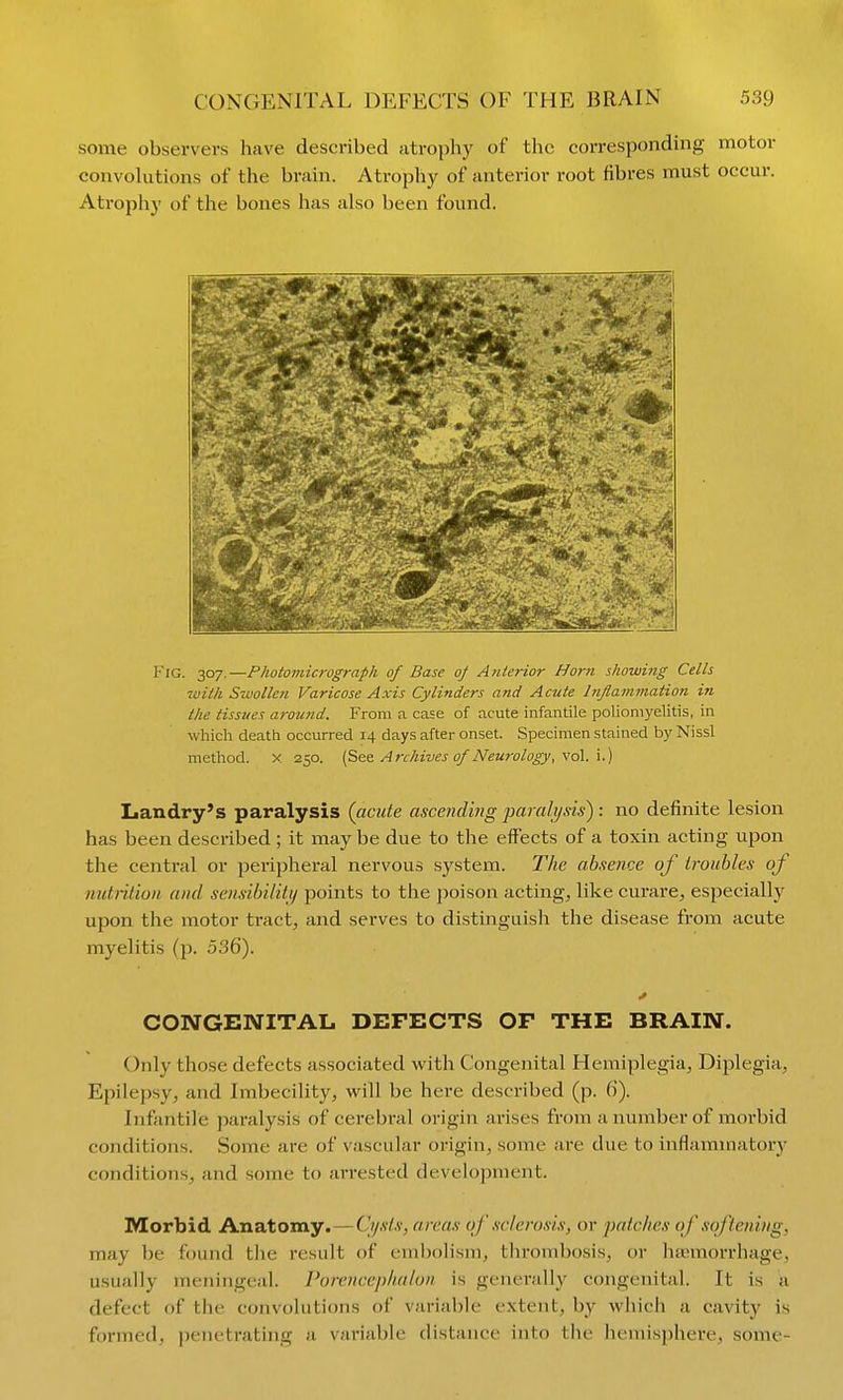 some observers have described atrophy of the corresponding motor convolutions of the brain. Atrophy of anterior root fibres must occur. Atrophy of the bones has also been found. Fig. 307.—Photomicrograph of Base oj Aiiterior Horn showing Cells 7uiih Swollen Varicose Axis Cylinders and Acute Inflammation in the tissues arotmd. From a case of acute infantile poliomyelitis, in which death occurred 14 days after onset. Specimen stained by Nissl method, x 250. [5<i<t Archives of Neurology, vol. i.) Landry's paralysis {acute ascending j^amlysis) : no definite lesion has been described; it may be due to the effects of a toxin acting upon the central or peripheral nervous system. The absence of troubles of nutiifion and sensibilitij points to the ])oison actings like curare, especially upon the motor tract, and serves to distinguish the disease from acute myelitis (p. 536). CONGENITAL DEFECTS OF THE BRAIN. Only those defects associated with Congenital Hemiplegia, Diplegia, Epilepsy, and Imbecility, will be here described (p. 6). Infantile paralysis of cerebral origin arises from a number of morbid conditions. Some are of vascular origin, some are due to inflammatory conditions, and some to arrested development. Morbid Anatomy.—Cysts, areas of sclerosis, or patches of softening, may be found the result of embolism, tlironibosis, or htemorrhage, usually meningeal. Porcncephalon is generally congenital. It is a defect of the convohitions of variable extent, by which a cavity is formed, penetrating a variable distance into the hemisphere, some-