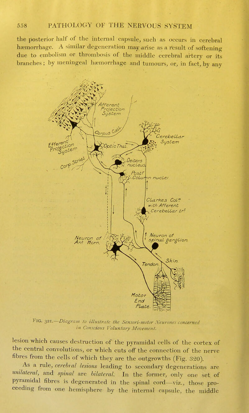 the posterior half of the internal capsule, such as occurs in cerebral haemorrhage. A similar degeneration may arise as a I'fesult of softening due to embolism or thrombosis of the middle cerebral ai-tery or its branches ; by meningeal htemorrhage and tumours, or, in fact, by any Fig. zit..—Diagram to illustrate the Sensori-motor .\ein oiics concented in Conscious Voluntary Movement. lesion which causes destruction of the pyramidal cells of the cortex of the central convolutions, or which cuts off the connection of the nerve fibres from the cells of which they are the outgrowths (Fig. 320). As a rule, cerebral lesiom leading to secondary degenerations are imilaieral, and spmal are hilateml. In the former, only one set of pyramidal fibres is degenerated in the spinal cord—viz., those pro- ceeding from one hemisphere by the internal capsule, the middle
