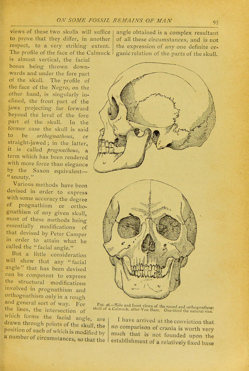 95 views of these two skulls will suffice to prove that they differ, in another respect, to a very striking extent. The profile of the face of the Calmtick is almost vertical, the facial bones being thrown down- wards and under the fore part of the skull. The profile of the face of the Negro, on the other hand, is singularly in- clined, the front part of the jaws projecting far forward beyond the level of the fore part of the skull. In the former case the skull is said to be orthognathous, or straight-jawed ; in the latter, it is called prognathous, a term which has been rendered with more force than elegance by the Saxon equivalent— snouty. Various methods have been devised in order to express with some accuracy the degree of prognathism or ortho- gnathism of any given skull, most of these methods being essentially modifications of that devised by Peter Camper in order to attain what he called the facial angle. But a little consideration will show that any facial angle  that has been devised can be competent to express the structural modifications involved in prognathism and orthognathism only in a rough and general sort of way. For the lines, the intersection of which forms the fecial angle, are drawn through points of the skull, the position of each of which is modified by a number of circumstances, so that the angle obtained is a complex resultant of all these circumstances, and is not the expression of any one definite or- ganic relation of the parts of the skull. Fig. 26. skull of a -Side and front views of the round and orthotrnathous 1 Calmuck, after Von Haer. One-third .he natural sfce! I have arrived at the conviction that no comparison of crania is worth very much that is not founded upon the establishment of a relatively fixed base