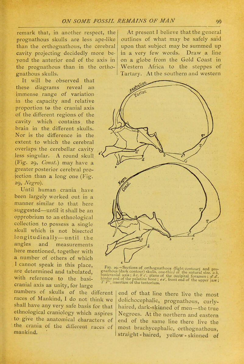 remark that, in another respect, the prognathous skulls are less ape-like than the orthognathous, the cerebral cavity projecting decidedly more be- yond the anterior end of the axis in the prognathous than in the ortho- gnathous skulls. It will be observed that these diagrams reveal an immense range of variation in the capacity and relative proportion te the cranial axis of the different regions of the cavity which contains the brain in the different skulls. Nor is the difference in the extent to which the cerebral overlaps the cerebellar cavity less singular. A round skull (Fig. 29, Const.) may have a greater posterior cerebral pro- jection than a long one (Fig. 29, Negro). Until human crania have been largely worked out in a manner similar to that here suggested—until it shall be an opprobrium to an ethnological collection to possess a single skull which is not bisected longitudinally—until the angles and measurements here mentioned, together with a number of others of which I cannot speak in this place, are determined and tabulated, with reference to the basi- cranial axis as unity, for large numbers of skulls of the different races of Mankind, I do not think we shall have any very safe basis for that ethnological craniology which aspires to give the anatomical characters of the crania of the different races of mankind. At present I believe that the general outlines of what may be safely said upon that subject may be summed up in a very few words. Draw a line on a globe from the Gold Coast in Western Africa to the steppes of Tartary. At the southern and western Fig. za.-Sections of orthognathoiis flight contour! and pro- gnathous (dark contour) skulls, one-third of the natural sUe. ab bas.cran.al axis; be, b'C, plane of the occipital foramen ; ,f <f, hinder end or the palatine bone ; -• T T', insertion or the tentorium ee', front end of the upper jaw; end of that line there live the most dolichocephalic, prognathous, curly- haired, dark-skinned of men—the true Negroes. At the northern and eastern end of the same line there live the most brachycephalic, orthognathous, straight - haired, yellow - skin ned of