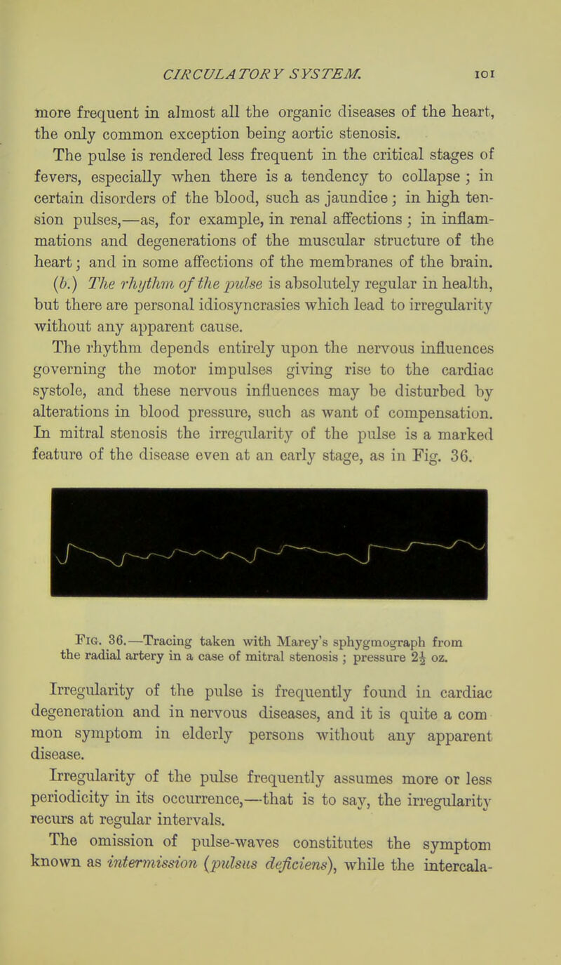 more frequent in almost all the organic diseases of the heart, the only common exception being aortic stenosis. The pulse is rendered less frequent in the critical stages of fevers, especially when there is a tendency to collapse ; in certain disorders of the blood, such as jaundice; in high ten- sion pulses,—as, for example, in renal affections ; in inflam- mations and degenerations of the muscular structure of the heart; and in some affections of the membranes of the brain. (6.) The rhythm of the pulse is absolutely regular in health, but there are personal idiosyncrasies which lead to irregularity without any apparent cause. The rhythm depends entirely upon the nervous influences governing the motor impulses giving rise to the cardiac systole, and these nervous influences may be disturbed by alterations in blood pressure, such as want of compensation. In mitral stenosis the irregularity of the pulse is a marked feature of the disease even at an early stage, as in Fig. 36. Fig. 36.—Tracing taken with Marey's sphygmograph from the radial artery in a case of mitral stenosis ; pressure 2^ oz. Irregularity of the pulse is frequently found in cardiac degeneration and in nervous diseases, and it is quite a com mon symptom in elderly persons without any apparent disease. Irregularity of the pulse frequently assumes more or less periodicity in its occurrence,—that is to say, the irregularity recurs at regular intervals. The omission of pulse-waves constitutes the symptom known as intermission (pulsus deficiens), while the intercala-