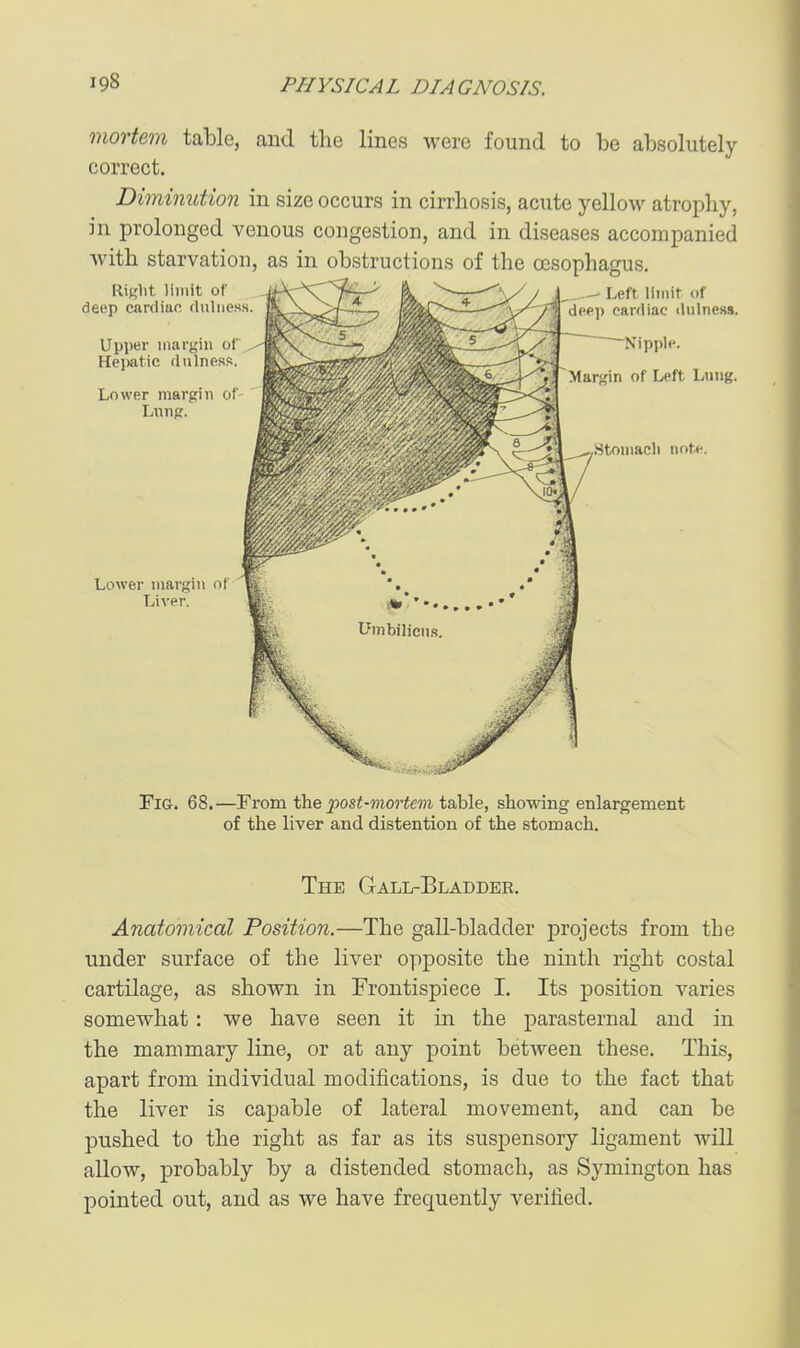 mortem table, and the lines were found to be absolutely correct. Diminution in size occurs in cirrhosis, acute yellow atrophy, in prolonged venous congestion, and in diseases accompanied Avith starvation, as in obstructions of the oesophagus. Pig. 68.—From the ^30si-mor<em table, showing enlargement of the liver and distention of the stomach. The Gall-Bladder. Anatomical Position.—The gall-bladder projects from the under surface of the liver opposite the ninth right costal cartilage, as shown in Frontispiece I. Its position varies somewhat: we have seen it in the parasternal and in the mammary line, or at any point between these. This, apart from individual modifications, is due to the fact that the liver is capable of lateral movement, and can be pushed to the right as far as its suspensory ligament will allow, probably by a distended stomach, as Symington has pointed out, and as we have frequently verified.