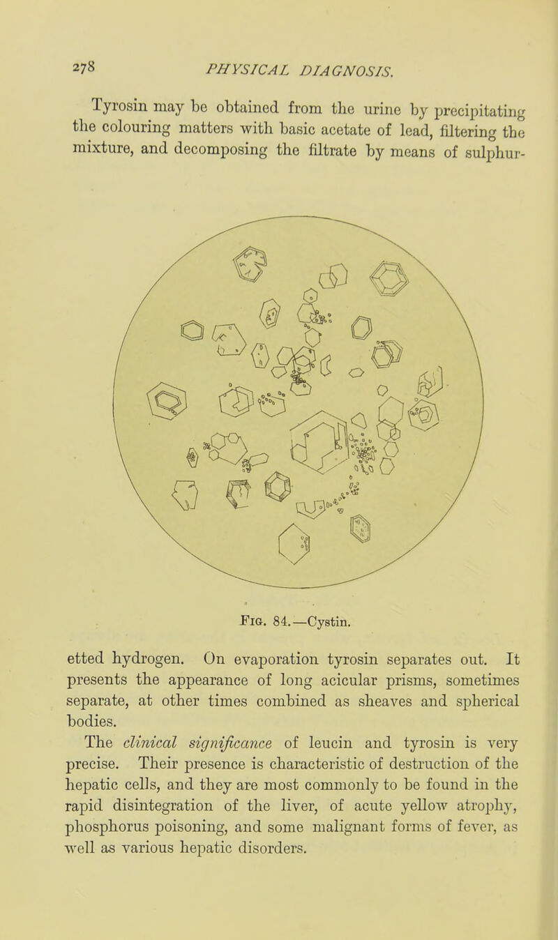 Tyrosin may be obtained from the urine by precipitating the colouring matters with basic acetate of lead, filtering the mixture, and decomposing the filtrate by means of sulphur- FiG. 84.—Cystin. etted hydrogen. On evaporation tyrosin separates out. It presents the appearance of long acicular prisms, sometimes separate, at other times combined as sheaves and spherical bodies. The clinical significance of leucin and tyrosin is very precise. Their presence is characteristic of destruction of the hepatic cells, and they are most commonly to be found in the rapid disintegration of the liver, of acute yellow atrophy, phosphorus poisoning, and some malignant forms of fever, as well as various hepatic disorders.