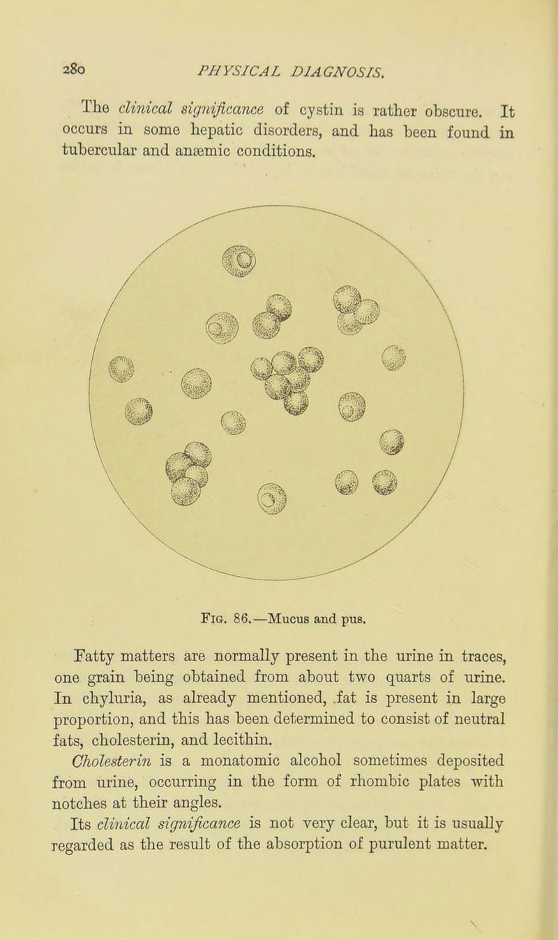 The clinical significance of cystin is rather obscure. It occurs in some hepatic disorders, and has been found in tubercular and anaemic conditions. Fig. 86.—Mucus and pus. Fatty matters are normally present in the urine in traces, one grain being obtained from about two quarts of urine. In chyluria, as already mentioned, .fat is present in large proportion, and this has been determined to consist of neutral fats, cholesterin, and lecithin. Gliolesterin is a monatomic alcohol sometimes deposited from urine, occurring in the form of rhombic plates with notches at their angles. Its clinical significance is not very clear, but it is usually regarded as the result of the absorption of purulent matter. \