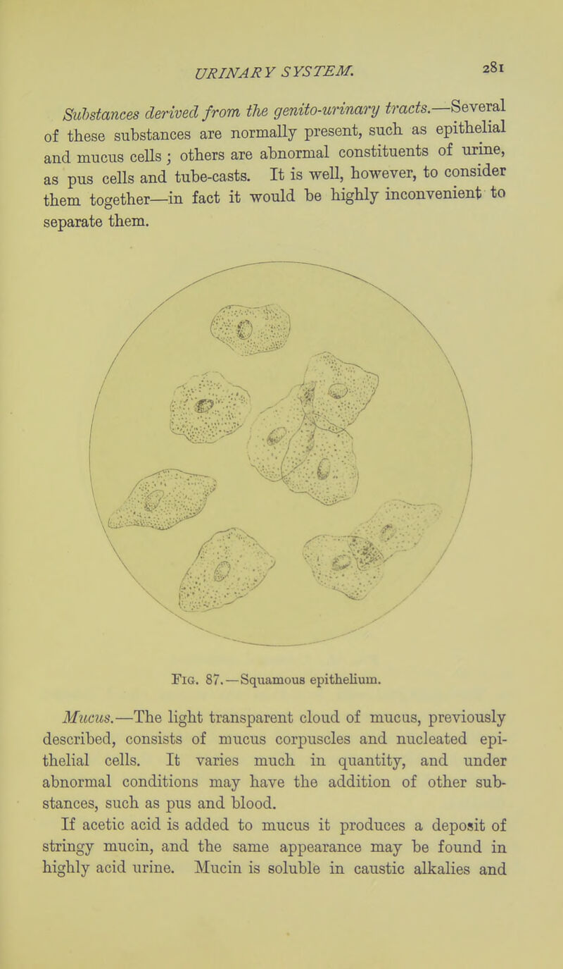 Suhstances derived from the genUo-urinarij tracts—Seyeral of these substances are normally present, such as epithelial and mucus cells ; others are abnormal constituents of urine, as pus cells and tube-casts. It is well, however, to consider them together—in fact it would be highly inconvenient to separate them. Fig. 87.—Squamous epithelium. Mucus.—The light transparent cloud of mucus, previously described, consists of mucus corpuscles and nucleated epi- thelial cells. It varies much in quantity, and under abnormal conditions may have the addition of other sub- stances, such as pus and blood. If acetic acid is added to mucus it produces a deposit of stringy mucin, and the same appearance may be found in highly acid urine. Mucin is soluble in caustic alkalies and