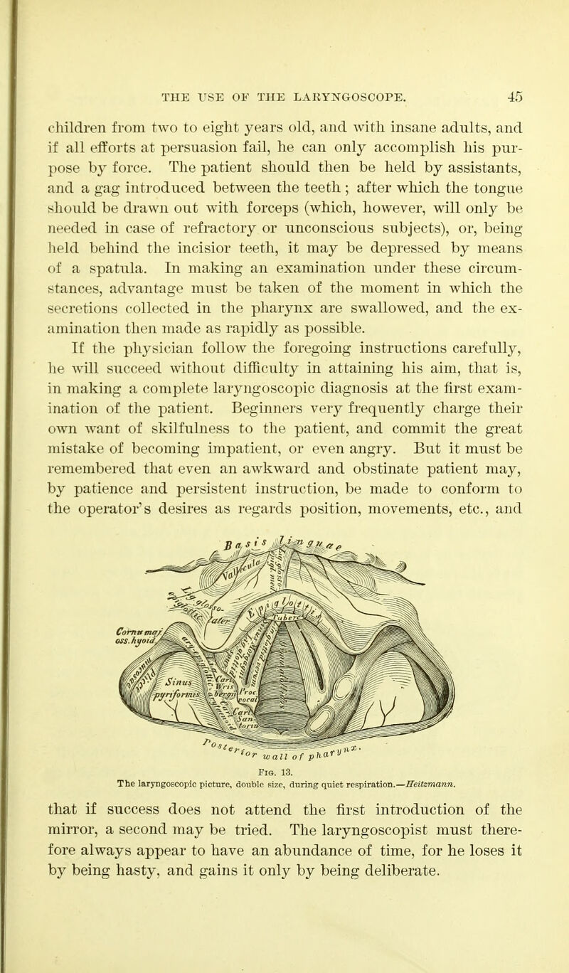 children from two to eight years old, and with insane adults, and if all efforts at persuasion fail, he can only accomplish his pur- pose by force. The patient should then be held by assistants, and a gag introduced between the teeth ; after which the tongue should be drawn out with forceps (which, however, will only be needed in case of refractory or unconscious subjects), or, being held behind the incisior teeth, it may be depressed by means of a spatula. In making an examination under these circum- stances, advantage must be taken of the moment in which the secretions collected in the pharynx are swallowed, and the ex- amination then made as rapidly as possible. If the physician follow the foregoing instructions carefully, he will succeed without difficulty in attaining his aim, that is, in making a complete laryngoscopic diagnosis at the first exam- ination of the patient. Beginners very frequently charge their own want of skilfulness to the patient, and commit the great mistake of becoming impatient, or even angry. But it must be remembered that even an awkward and obstinate patient may, by patience and persistent instruction, be made to conform to the operator's desires as regards position, movements, etc., and Fig. 13. The laryngoscopic picture, double size, during quiet respiration.—Heitzmann. that if success does not attend the first introduction of the mirror, a second may be tried. The laryngoscopist must there- fore always appear to have an abundance of time, for he loses it by being hasty, and gains it only by being deliberate.