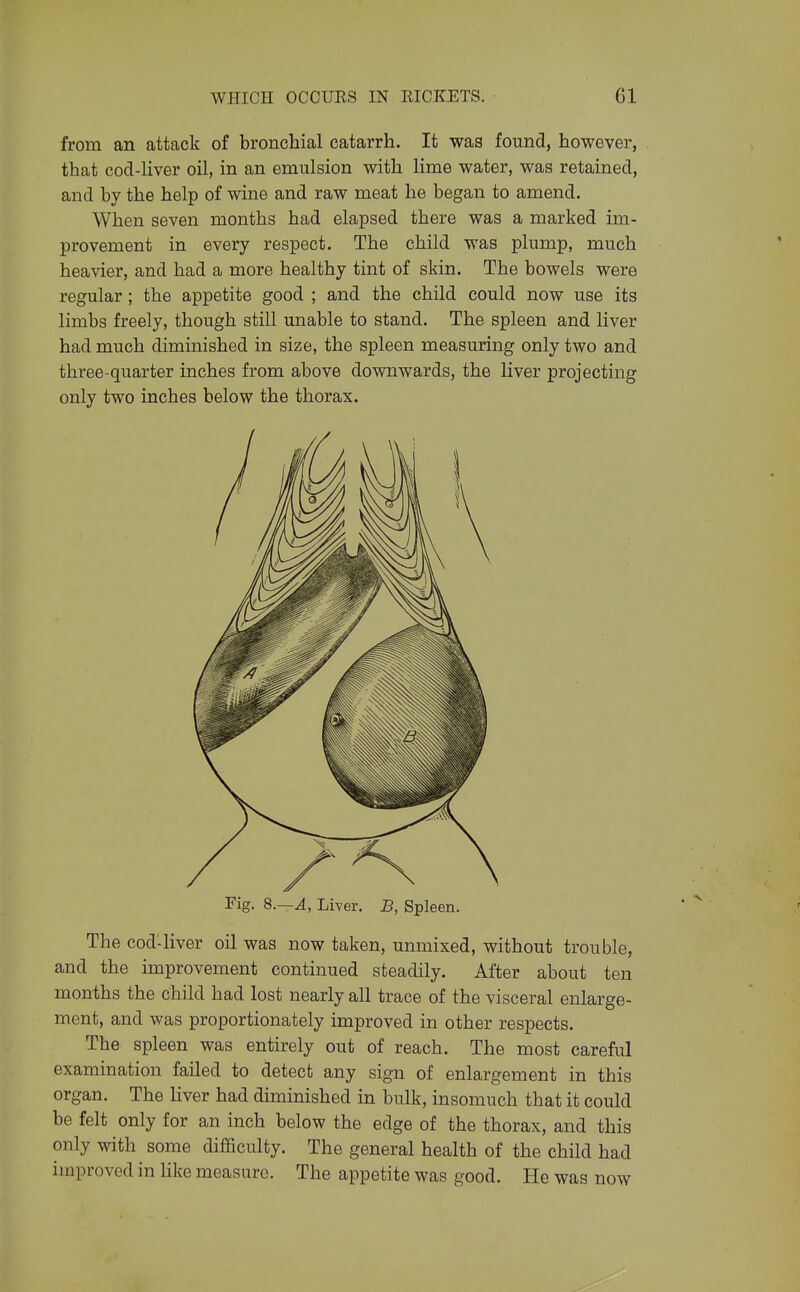 from an attack of bronchial catarrh. It was found, however, that cod-liver oil, in an emulsion with lime water, was retained, and by the help of wine and raw meat he began to amend. When seven months had elapsed there was a marked im- provement in every respect. The child was plump, much heavier, and had a more healthy tint of skin. The bowels were regular; the appetite good ; and the child could now use its limbs freely, though still unable to stand. The spleen and liver had much diminished in size, the spleen measuring only two and three-quarter inches from above downwards, the liver projecting only two inches below the thorax. Fig. 8.—^, Liver. B, Spleen. The cod-liver oil was now taken, unmixed, without trouble, and the improvement continued steadily. After about ten months the child had lost nearly all trace of the visceral enlarge- ment, and was proportionately improved in other respects. The spleen was entirely out of reach. The most careful examination failed to detect any sign of enlargement in this organ. The liver had diminished in bulk, insomuch that it could be felt only for an inch below the edge of the thorax, and this only with some difficulty. The general health of the child had improved in Hke measure. The appetite was good. He was now