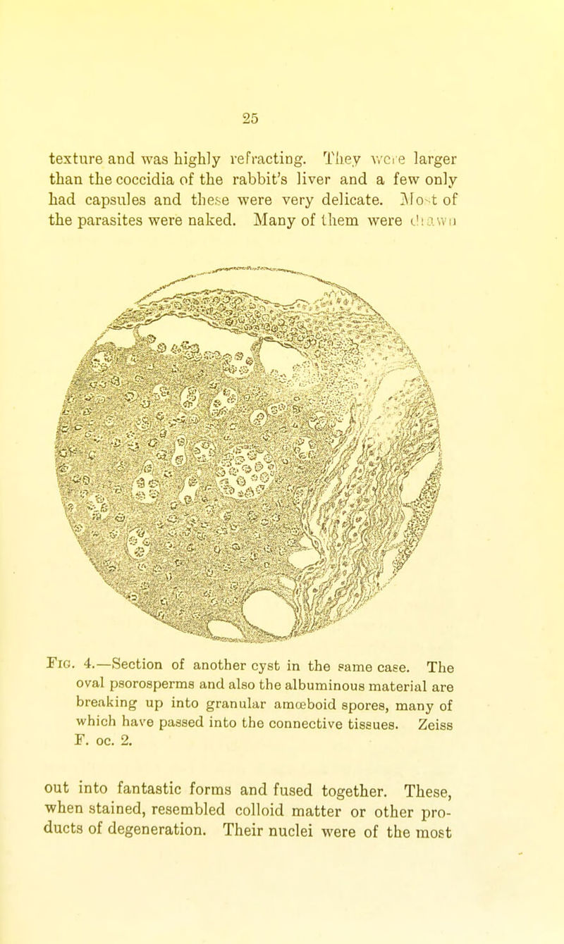 texture and was highly refracting. They v.'Ci e larger than the coccidia of the rabbit's liver and a few only had capsules and these were very delicate. j\Io-t of the parasites were naked. Many of lliem were c! i a w n Tig. 4.—Section of another cyst in the pame case. The oval psorosperma and also the albuminous material are breaking up into granular amoeboid spores, many of which have passed into the connective tissues. Zeiss F. oc. 2. out into fantastic forms and fused together. These, when stained, resembled colloid matter or other pro- ducts of degeneration. Their nuclei were of the most