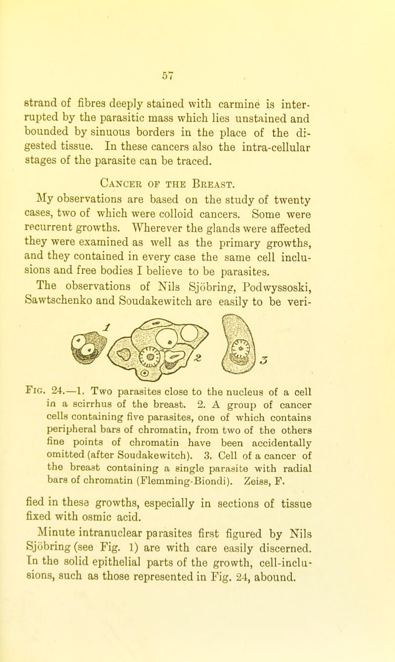 strand of fibres deeply stained with carmine is inter- rupted by the parasitic mass which lies unstained and bounded by sinuous borders in the place of the di- gested tissue. In these cancers also the intra-cellular stages of the parasite can be traced. CajStcer of the Breast. My observations are based on the study of twenty cases, two of which were colloid cancers. Some were recurrent growths. Wherever the glands were affected they were examined as well as the primary growths, and they contained in every case the same cell inclu- sions and free bodies I believe to be parasites. The observations of Nils Sjobring, Podwyssoski, Sawtschenko and Soudakewitch are easily to be veri- FiG. 24.—1. Two parasites close to the nucleus of a cell in a scirrhus of the breast. 2. A group of cancer cells containing five parasites, one of which contains peripheral bars of chromatin, from two of the others fine points of chromatin have been accidentally omitted (after Soudakewitch). 3. Cell of a cancer of the breast containing a single parasite with radial bars of chromatin (Flemming-Biondi). Zeiss, F. fied in these growths, especially in sections of tissue fixed with osmic acid. Minute intranuclear parasites first figured by Nils Sjobring (see Fig. 1) are with care easily discerned. In the solid epithelial parts of the growth, cell-inclu- sions, such as those represented in Fig. 24, abound.
