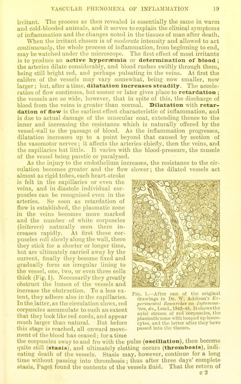 irritant. The process as then revealed is essentially the same in warm and cold-blooded animals, and it serves to explain the clinical symijtoms of inflammation and the changes noted in the tissues of man after death. When the irritant chosen is of moderate intensity and allowed to act continuoushj, the whole process of inflammation, from beginning to end, may be watched under the microscope. The first effect of most irritants is to produce an active bypersemia or determination of blood ; the arteries dilate considerably, and blood rushes swiftly through them, being still bright red, and perhaps pulsating in the veins. At first the calibre of the vessels may vary somewhat, being now smaller, now larger; but, after a time, dilatation increases steadily. The accele- ration of flow continues, but sooner or later gives place to retardation ; the vessels are so mde, however, that in spite of this, the discharge of blood from the veins is greater than normal. Dilatation with retar- dation of flow is the earliest eft'ect characteristic of inflammation, and is due to actual damage of the muscular coat, extending thence to the inner and increasing the resistance which is naturally offered by the vessel-wall to the passage of blood. As the inflammation progresses, dilatation increases up to a i)oint beyond that caused by section of the vasomotor nerves; it affects the arteries chiefly, then the veins, and the capillaries but little. It varies with the blood-pressure, the muscle of the vessel being paretic or paralysed. As the injury to the endothelium increases, the resistance to the cir- culation becomes greater and the flow slower; the dilated vessels act almost as rigid tubes, each heart-stroke is felt in the capillaries or even the veins, and in diastole individual cor- puscles can be recognised even in the arteries. So soon as retardation of flow is established, the plasmatic zone in the veins becomes more marked and the number of white corpuscles (loiterers) naturally seen there in- creases rapidly. At first these cor- puscles roll slowly along the wall, there they stick for a shorter or longer time, but are ultimately carried away by the current, finally they become fixed and gradually form an irregular lining to the vessel, one, two, or even three cells thick (Fig. 1). Necessarily they greatly obstruct the lumen of the vessels and increase the obstruction. To a less ex- tent, they adhere also in tlic capillaries. In the latter, as the circulation slows, red corpuscles accumulate to such an extent that they look like red cords, and appear much larger than natural. But before this stage is reached, all onward move- ment of the blood has ceased; for a time the corpuscles sway to and fro with the pulse (oscillation), then becomo quite still (stasis), and ultimately clotting occurs (tbrombosls), indi- cating death of the vessels. Stasis may, however, continue for a long time without passing into thrombosis ; thus after three days' completo stasis, Paget found the contents of the vessels fluid. That the return of c 2 Fig. 1.—After one of the originiU drawings in Dr. W. Addison's IC.i- penmenfdl Hesetiirlics on Injiitmmii- Hoii, iLc, Land., 1843-45. Itsliowstho axial stream of red corpuscles, tho plasmatic zone with heaped up leuco- cytes, and the latter after they havo passed into the tissues.