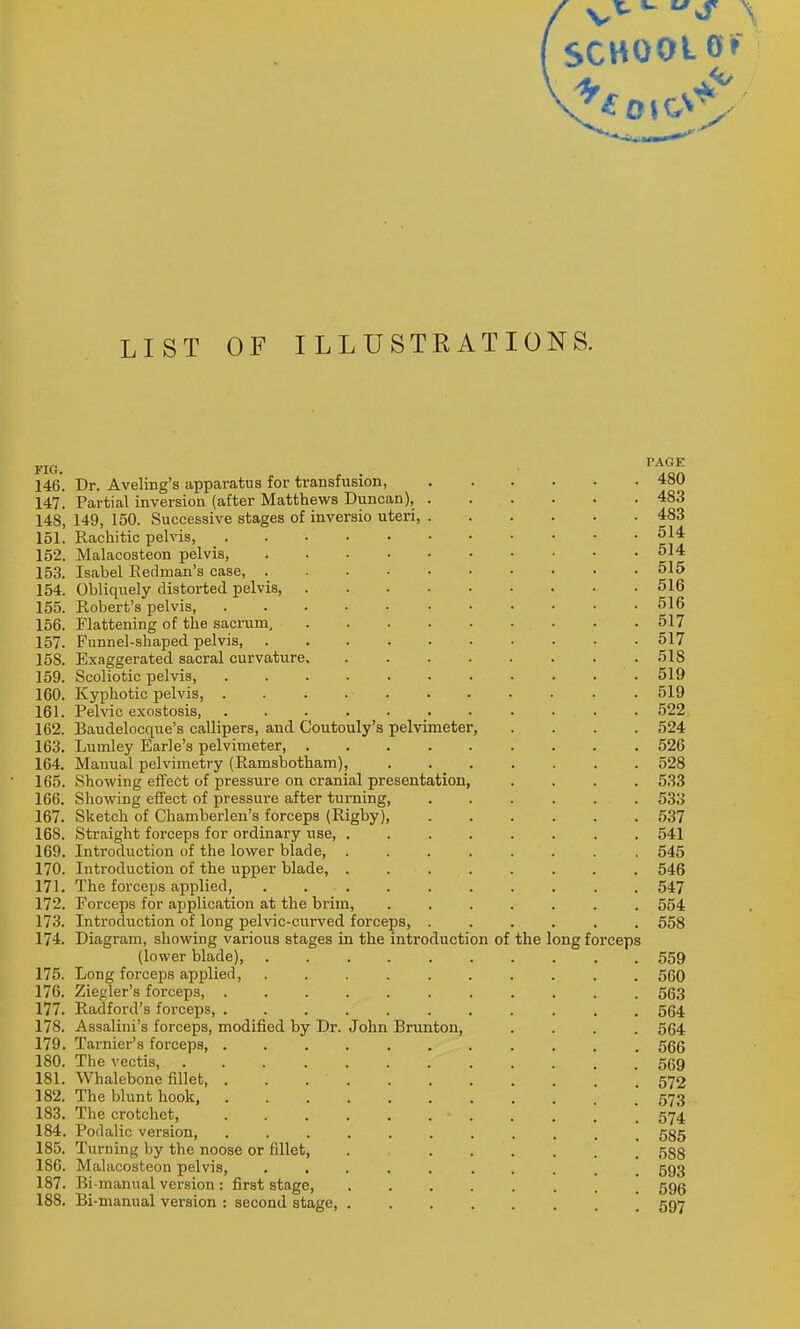 SCHOOL LIST OF ILLUSTRATIONS. FIG. ^^^'^ 146. Dr. Aveling's apparatus for transfusion, 480 147. Partial inversion (after Matthews Duncan), 483 148. 149, 150. Successive stages of inversio uteri, 483 151. Rachitic pelvis, 514 152. Malacosteon pelvis, 514 153. Isabel Eedman's case, 515 154. Obliquely distorted pelvis, 516 155. Robert's pelvis, 516 156. Flattening of the sacrum, 517 157. Funnel-shaped pelvis, 517 158. Exaggerated sacral curvature 518 159. Scoliotic pelvis, 519 160. Kyphotic pelvis, 519 161. Pelvic exostosis 522 162. Baudelocque's callipers, and Coutouly's pelvimeter, .... 524 163. Lumley Earle's pelvimeter, 526 164. Manual pelvimetry (Ramsbotham), 528 165. Showing effect of pressure on cranial presentation, .... 533 166. Showing effect of pressure after turning, 533 167. Sketch of Chamberlen's forceps (Rigby), 537 168. Straight forceps for ordinary use, 541 169. Introduction of the lower blade, ........ 545 170. Introduction of the upper blade, ........ 546 171. The forceps applied, 547 172. Forceps for application at the bi'im, ....... 554 173. Introduction of long pelvic-curved forceps, ...... 558 174. Diagram, showing various stages in the introduction of the long forceps (lower blade), .......... 559 175. Long forceps applied, 560 176. Ziegler's forceps, 563 177. Radford's forceps 564 178. Assalini's forceps, modified by Dr. John Brunton, .... 564 179. Tarnier's forceps, 566 180. The vectis, 569 181. Whalebone fillet, . . 572 182. The blunt hook . 573 183. The crotchet, ........... 574 184. Podalic version, ........... 535 185. Turning by the noose or fillet, . , 553 186. Malacosteon pelvis, .......... 593 187. Bi manual version : first stage, ........ 596 188. Bi-manual version : second stage, ........ 597