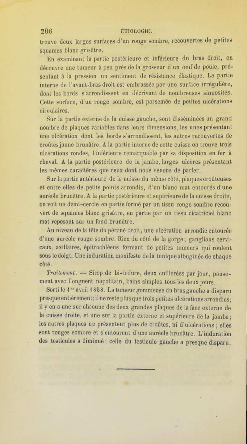 20G ËTI0L0G1E. trouve deux larges surfaces d'un rouge sombre, recouvertes de petites squames blanc grisâtre. En examinant la partie postérieure et inférieure du bras droit, on découvre une tumeur à peu près de la grosseur d'un œuf de poule, pré- sentant à la pression un sentiment de résistance élastique. La partie interne de l'avant-bras droit est embrassée par une surface irrégulière, dont les bords s'arrondissent en décrivant de nombreuses sinuosités. Cette surface, d'un rouge sombre, est parsemée de petites ulcérations circulaires. Sur la partie externe de la cuisse gauche, sont disséminées un grand nombre de plaques variables dans leurs dimensions, les unes présentant une ulcération dont les bords s'arrondissent, les autres recouvertes de croûtes jaune brunâtre. A la partie interne de cette cuisse on trouve trois ulcérations rondes, l'inférieure remarquable par sa disposition en fer à cheval. A la partie postérieure de la jambe, larges ulcères présentant les mêmes caractères que ceux dont nous venons de parler. Sur la partie antérieure de la cuisse du même côté, plaques croûteuses et entre elles de petits points arrondis, d'un blanc mat entourés d'une auréole brunâtre. A la partie postérieure et supérieure de la cuisse droite, on voit un demi-cercle en partie formé par un tissu rouge sombre recou- vert de squames blanc grisâtre, en partie par un tissu cicatriciel blanc mat reposant sur un fond brunâtre. Au niveau de la tête du péroné droit, une ulcération arrondie entourée d'une auréole rouge sombre. Rien du côté de la gorge; ganglions cervi- caux, axillaires, épitrochléens formant de petites tumeurs qui roulent sous le doigt. Une induration manifeste de la tunique albuginée de chaque côté. Traitement. — Sirop de bi-iodure, deux cuillerées par jour, panse- ment avec l'onguent napolitain, bains simples tous les deux jours. Sorti le 4er avril 4 858. La tumeur gommeuse du bras gauche a disparu presque entièrement; il ne reste plusque trois petites ulcérations arrondies; il y en a une sur chacune des deux grandes plaques de la face externe de la cuisse droite, et une sur la partie externe et supérieure de la jambe; les autres plaques ne présentent plus de croûtes, ni d'ulcérations; elles sont rouges sombre et s'entourent d'une auréole brunâtre. L'induration des testicules a diminué; celle du testicule gauche a presque disparu.