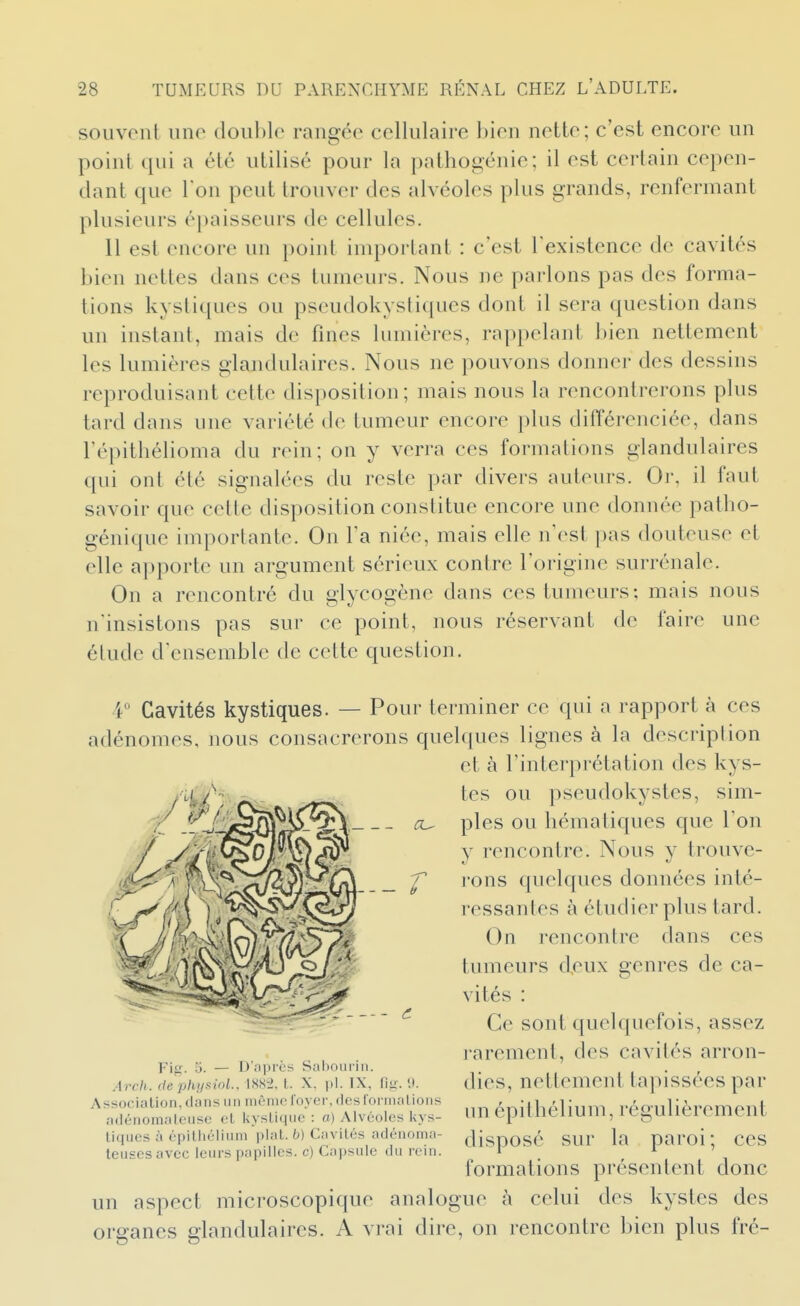 souvent une doul)lo rangée cellulaire bien nette; c'est encore un point qui a été utilisé pour la pathogénie; il est certain cepen- dant que Ton peut trouver des alvéoles plus grands, renfermant plusieurs épaisseurs de cellules. 11 est encore un point important : c'est l'existence de cavités bien nettes dans ces tumeurs. Nous ne parlons pas des forma- tions kystiques ou pseudokystiques dont il sera question dans un instant, mais de fines lumières, rappelant ])ien nettement les lumières glandulaires. Nous ne pouvons donner des dessins reproduisant cette disposition ; mais nous la rencontrerons plus tard dans une variété de tumeur encore plus différenciée, dans l'épithélioma du rein; on y verra ces formations glandulaires qui ont été signalées du reste par divers auteurs. Oi-, il faut savoir que celle disposition constitue encore une donnée patho- génique importante. On Fa niée, mais elle nVst pas douteuse et elle apporte un argument sérieux contre l'origine surrénale. On a rencontré du glycogène dans ces tumeurs; mais nous n'insistons pas sur ce point, nous réservant de faire une étude d'ensemble de cette question. _ - eu î \ Cavités kystiques. — Pour terminer ce qui a rapport à ces adénomes, nous consacrerons quelques lignes à la description et à l'interprétation des kys- tes ou pseudokystes, sim- ples ou hématiques que l'on y rencontre. Nous y trouve- rons quelques données inté- ressantes à étudier plus tard. On rencontre dans ces tumeurs deux genres de ca- vités : Ce sont quelquefois, assez rarement, des cavités arron- dies, nettement tapissées par un épithélium, régulièrement disposé sur la paroi; ces formations présentent donc un aspect microscopique analogue à celui des kystes des organes glandulaires. A vrai dire, on rencontre bien plus fré- Fig. 5. — D'nprcs Sahoiirin. Arch. de physiol., 1882, t. X. i)l. IX, fig. '.i. Association, dans un môme foyer, des formations adénomateuse et kystique: o) Alvéoles kys- tiques à cpilliélium plat, b) Cavités adénoma- teusesavcc leurs papilles, c) Capsule du rein.