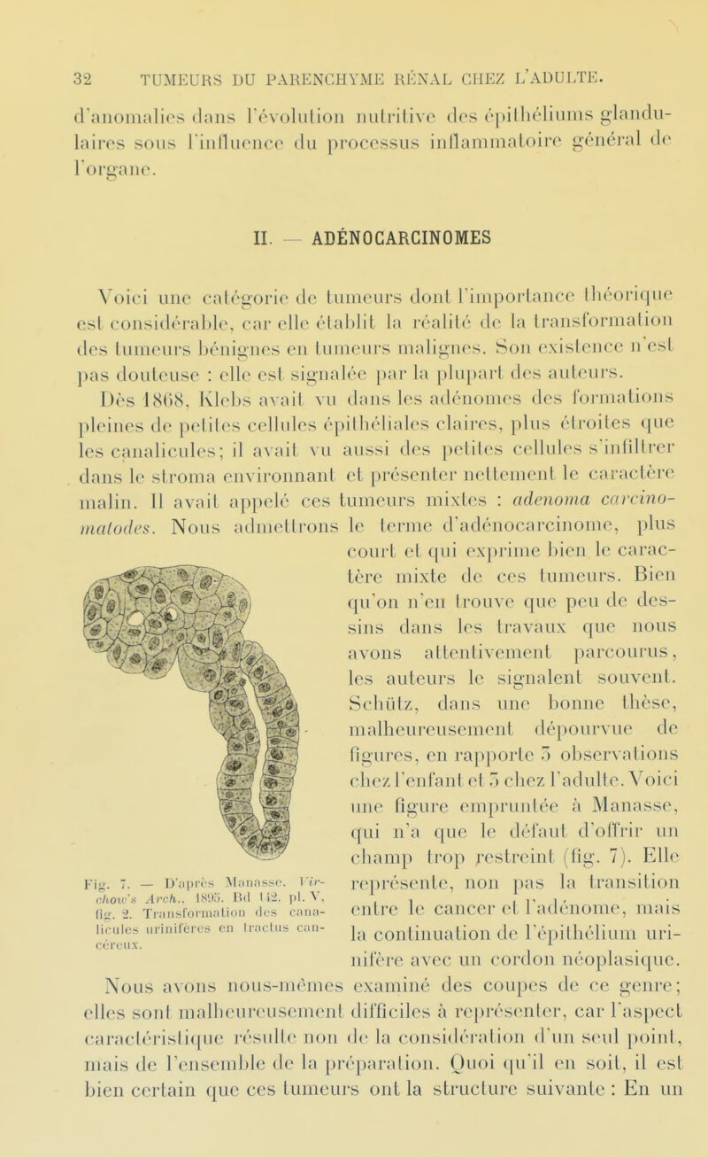 d anomalios dans révoliilioii nutritive des épilhéliums glandu- laires sous rinlluence du processus inflammatoire général de l'organe. II. ADÉNOCARCINOMES Voici une catégorie de tumeurs dont Timportance théorique est considérable, car elle établit la réalité de la transformation des tumeurs bénignes en tumeurs malignes. Son existence n'est pas douteuse : elle est signalée par la plupar-t des auteurs. Des 1868. Klebs avait vu dans les adénomes des formations pleines de petites cellules épiihéliales claires, plus étroites que les canalicules; il avait vu aussi des petites cellules s'infiltrer dans le stroma environnant et présenter nettement le caractère malin. Il avait appelé ces tumeurs mixtes : adenoma carcino- malodes. Nous admettrons le terme d'adénocarcinome, plus court et qui exprime bien le carac- tère mixte de ces tumeurs. Bien qu'on n'en trouve que peu de des- sins dans les travaux que nous avons attentivement parcourus, les auteurs le signalent souvent. Schûtz, dans une bonne thèse, malheureusement dépourvue de figures, en rapporte o observations chez l'enfant et 5 chez l'adulte. Voici mie figure empruntée à Manasse, qui n'a que le défaut d'oflVir un champ trop restreint (fig. 7). Elle représente, non pas la transition entre le cancer et l'adénome, mais la continuation de l'épithélium uri- nifère avec un cordon néoplasique. Nous avons nous-mêmes examiné des coupes de ce genre; elles sont malheureusement difficiles à représenter, car l'aspect caractéristique résulte non de la considération d'un seul point, mais de l'ensemble de la préparation. Quoi qu'il en soit, il est bien certain que ces tumeurs ont la structure suivante : En un Si)-,... Fig. 7. — D'iipirs Mjmnsso. lïr- choivs Arch.. IS'Jo. lUl l l'i. pl. V, fig. i. Transformation ries cana- licules iirinilères en Iraclus can- céreux.