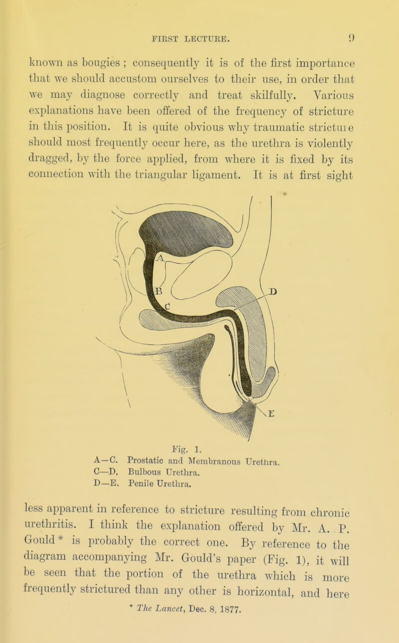 known as bougies ; consequently it is of the first importance that we should accustom ourselves to their use, in order that we may diagnose correctly and treat skilfully. Various explanations have been offered of the frequency of stricture in this position. It is quite obvious why traumatic strictuie should most frequently occur here, as the urethra is violently dragged, by the force applied, from where it is fixed by its connection with the triangular ligament. It is at first sight Fig. 1. A—C. Prostatic and Membranous Urethra. C—D. Bulbous Urethra. D—E. Penile Urethra. less apparent in reference to stricture resulting from chronic urethritis. I think the explanation offered by Mr. A. P. Gould* is probably the correct one. By reference to the diagram accompanying Mr. Gould's paper (Fig. 1), it will be seen that the portion of the urethra which is more frequently strictured than any other is horizontal, and here * The Lancet, Dec. 8, 1877.