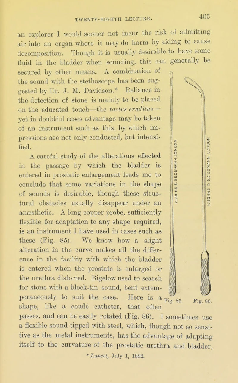 an explorer I would sooner not incur the risk of admitting air into an organ where it may do harm by aiding to cause decomposition. Though it is usually desirable to have some fluid in the bladder when sounding, this can generally be secured by other means. A combination of the sound with the stethoscope has been sug- gested by Dr. J. M. Davidson.* Keliance in the detection of stone is mainly to be placed on the educated touch—the tactus eruditus— yet in doubtful cases advantage may be taken of an instrument such as this, by which im- pressions are not only conducted, but intensi- fied. A careful study of the alterations effected the passage by which the bladder is m Fig. 85. entered in prostatic enlargement leads me to conclude that some variations in the shape of sounds is desirable, though these struc- tural obstacles usually disappear under an anaesthetic. A long copper probe, sufficiently flexible for adaptation to any shape required, is an instrument I have used in cases such as these (Fig. 85). We know how a slight alteration in the curve makes all the differ- ence in the facility with which the bladder is entered when the prostate is enlarged or the urethra distorted. Bigelow used to search for stone with a block-tin sound, bent extem- poraneously to suit the case. Here is a shape, like a coude catheter, that often passes, and can be easily rotated (Fig. 86). I sometimes use a flexible sound tipped with steel, which, though not so sensi- tive as the metal instruments, has the advantage of adapting itself to the curvature of the prostatic urethra and bladder, Fig. 86.