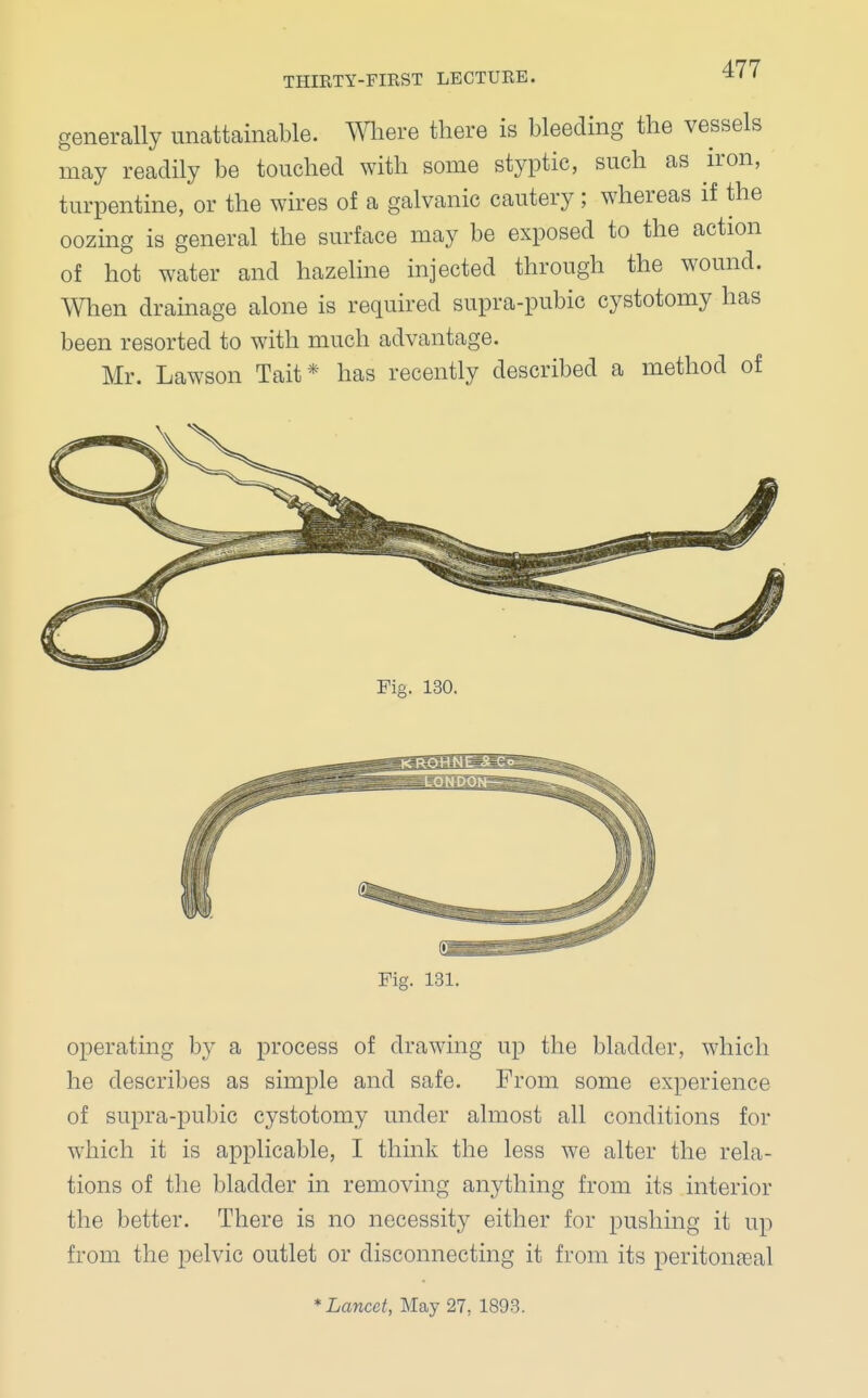 generally unattainable. Where there is bleeding the vessels may readily be touched with some styptic, such as iron, turpentine, or the wires of a galvanic cautery; whereas if the oozing is general the surface may be exposed to the action of hot water and hazeline injected through the wound. When drainage alone is required supra-pubic cystotomy has been resorted to with much advantage. Mr. Lawson Tait* has recently described a method of Fie. 130. Fig. 131. operating by a process of drawing up the bladder, which he describes as simple and safe. From some experience of supra-pubic cystotomy under almost all conditions for which it is applicable, I think the less we alter the rela- tions of the bladder in removing anything from its interior the better. There is no necessity either for pushing it up from the pelvic outlet or disconnecting it from its peritoneal * Lancet, May 27, 1893.