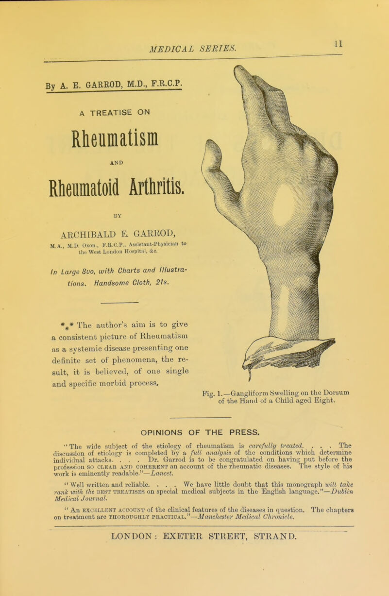 By A. E. GARROD, M.D., F.R.C.P. A TREATISE ON Rheumatism AND Rheumatoid Arthritis. BY ARCHIBALD E. GARROD, M.A., M.D. Oxou., F.R.C.P., Assistaiit-Pliysician to the West Loiulou Hospital, cSic. In Large 8vo, with Charts and lllustm- tions. Handsome Cloth, 21s. The author's aim is to give a consistent picture of Rheumatism as a systemic disease presenting one definite set of phenomena, the re- sult, it is believed, of one single and specific morbid process. of the Hand of a Child aged KjV OPINIONS OF THE PRESS. The wide subject of the etiology of rheumatism is carefully treated. . . . The discussion of etiology is completed by a full (malysis of the conditions which determine individual attacks. . . . Dr. Garrod is to be congratulated on having piit before the profession SO clear and coherent an account of the rheumatic diseases. The style of his work is eminently readable.—Lancet. Well written and reliable. . . . We have little doubt that this monograph ivili take rank with the be.st treatises on special medical subjects in the English langiiage.—Dublin Medical Journal. An EXCELLENT ACCOUNT of the clinical features of the diseases in qiiestion. The chapters on treatment are thoroughly practical.—Manchester Medical Chronicle.