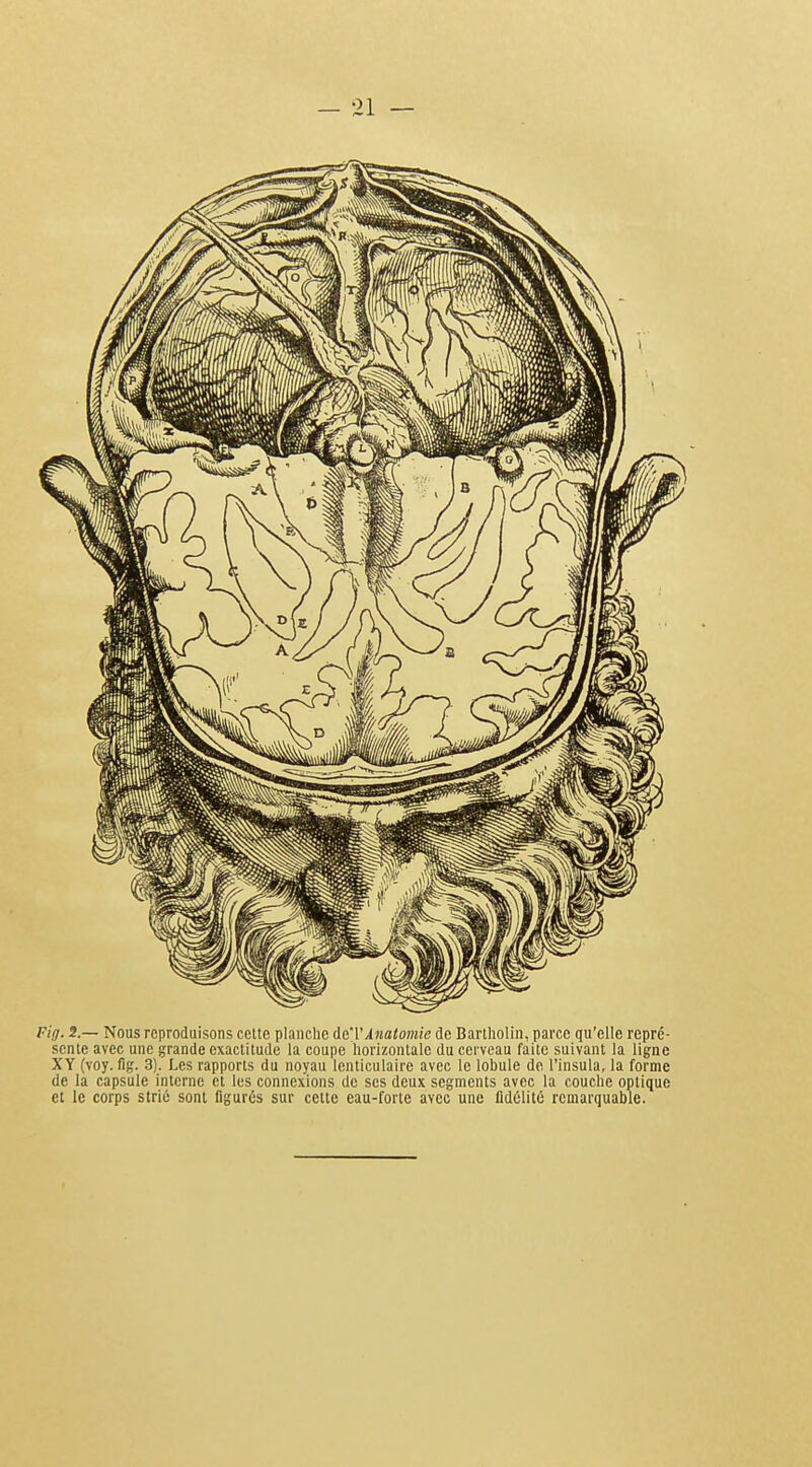 Fig. S.— Nous reproduisons cette planche de'VÀnato7nie de Bartliolin, parce qu'elle repré- sente avec une grande exactitude la coupe horizontale du cerveau faite suivant la ligne XY (voy. fig. 3). Les rapports du noyau lenticulaire avec le lobule de l'insula, la forme de la capsule interne et les connexions de ses deux segments avec la couche optique et le corps strié sont figurés sur cette eau-forte avec une fidélité remarquable.