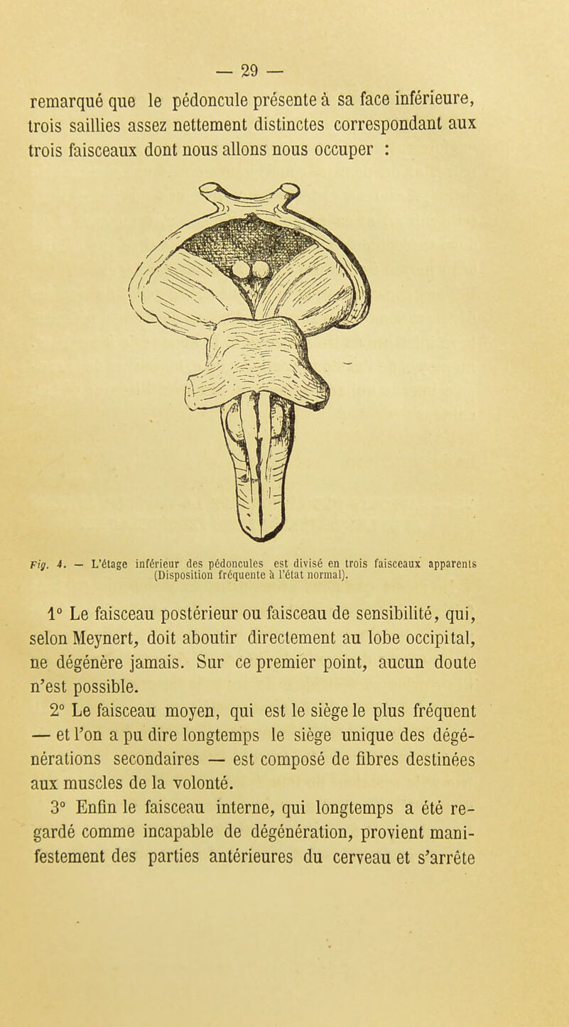 remarqué que le pédoncule présente à sa face inférieure, trois saillies assez nettement distinctes correspondant aux trois faisceaux dont nous allons nous occuper : Fig. 4. — L'étage inférieur des pédoncules est divisé en trois faisceaux apparents (Disposition fréquente h l'état normal). 1° Le faisceau postérieur ou faisceau de sensibilité, qui, selon Meynert, doit aboutir directement au lobe occipital, ne dégénère jamais. Sur ce premier point, aucun doute n'est possible. 2° Le faisceau moyen, qui est le siège le plus fréquent — et l'on a pu dire longtemps le siège unique des dégé- nérations secondaires — est composé de fibres destinées aux muscles de la volonté. 3 Enfin le faisceau interne, qui longtemps a été re- gardé comme incapable de dégénération, provient mani- festement des parties antérieures du cerveau et s'arrête