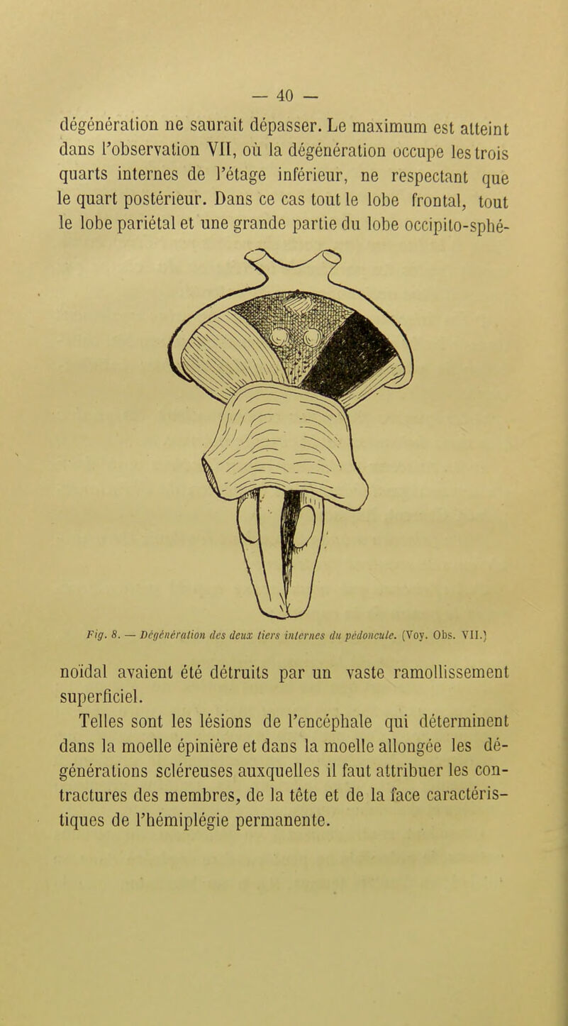 dégénération ne saurait dépasser. Le maximum est atteint dans l'observation VU, où la dégénération occupe les trois quarts internes de l'étage inférieur, ne respectant que le quart postérieur. Dans ce cas tout le lobe frontal, tout le lobe pariétal et une grande partie du lobe occipito-sphé- Fig. 8. — Dégénération des deux tiers internes du pédoncule. (Voy. Obs. VU.) noïdal avaient été détruits par un vaste ramollissement superficiel. Telles sont les lésions de l'encéphale qui déterminent dans la moelle épinière et dans la moelle allongée les dé- générations scléreuses auxquelles il faut attribuer les con- tractures des membres, de la tête et de la face caractéris- tiques de l'hémiplégie permanente.