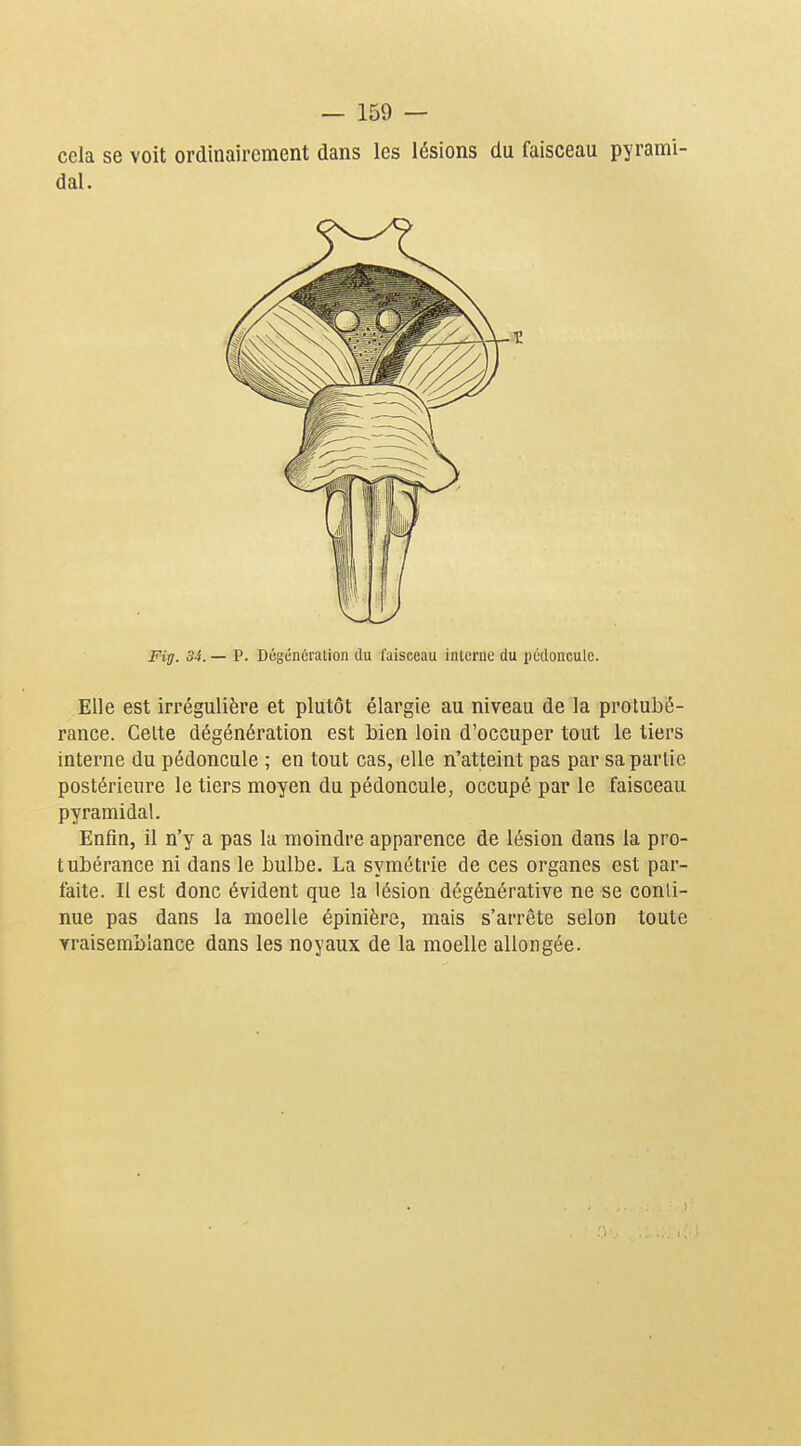 cela se voit ordinairement dans les lésions du faisceau pyrami- dal. Fig. 34. — P. Dûgénéraiion du faisceau interne du pédoncule. Elle est irrégulière et plutôt élargie au niveau de la protubé- rance. Celte dégénération est bien loin d'occuper tout le tiers interne du pédoncule ; en tout cas, elle n'atteint pas par sa partie postérieure le tiers moyen du pédoncule, occupé par le faisceau pyramidal. Enfin, il n'y a pas la moindre apparence de lésion dans la pro- tubérance ni dans le bulbe. La symétrie de ces organes est par- faite. II est donc évident que la lésion dégénérative ne se conli- nue pas dans la moelle épinière, mais s'arrête selon toute vraisemblance dans les noyaux de la moelle allongée.