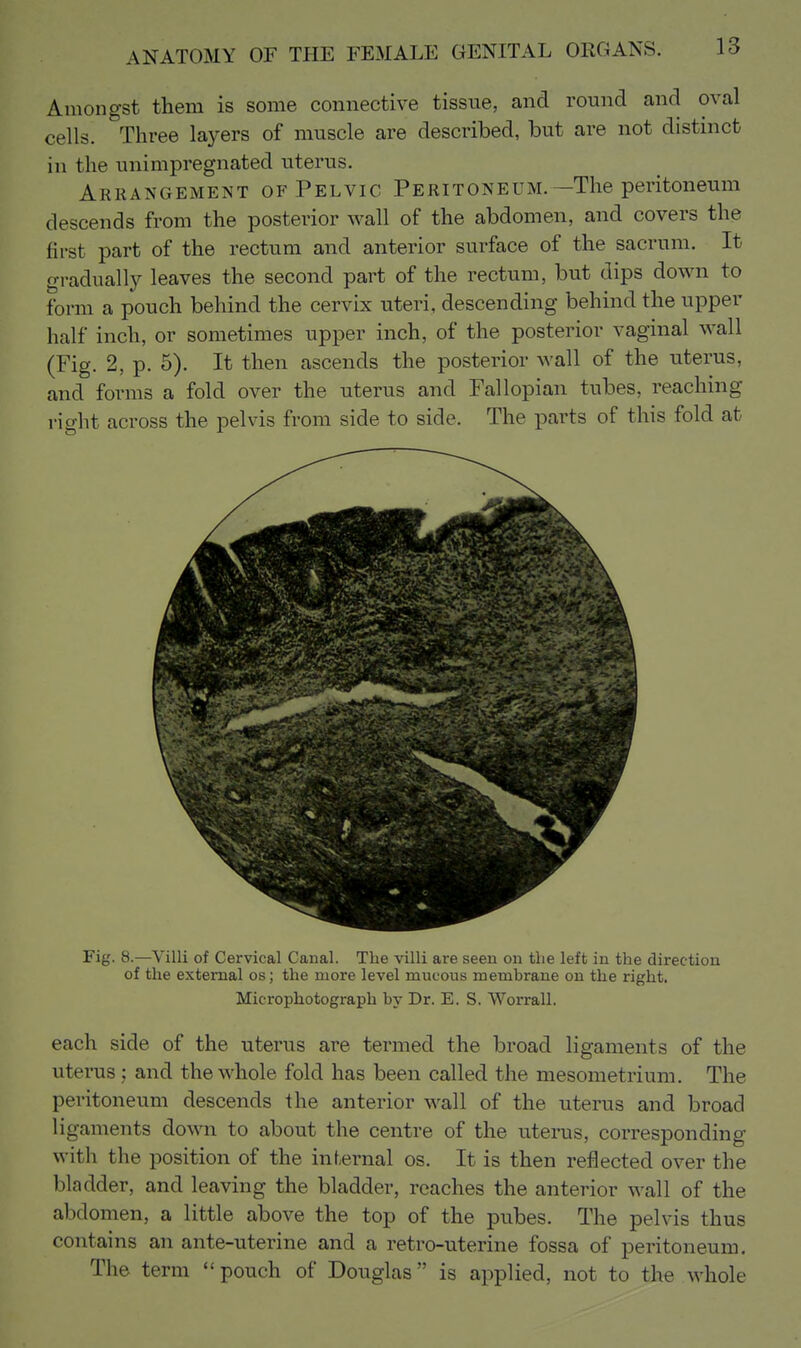 Amongst them is some connective tissue, and round and oval cells. Three layers of muscle are described, but are not distinct in the unimpregnated uterus. Arrangement of Pelvic Peritoneum.—The peritoneum descends from the posterior wall of the abdomen, and covers the first part of the rectum and anterior surface of the sacrum. It gradually leaves the second part of the rectum, but dips down to form a pouch behind the cervix uteri, descending behind the upper half inch, or sometimes upper inch, of the posterior vaginal wall (Fig. 2, p. 5). It then ascends the posterior wall of the uterus, and forms a fold over the uterus and Fallopian tubes, reaching right across the pelvis from side to side. The parts of this fold at Fig. 8.—Villi of Cervical Canal. The villi are seen on the left in the direction of the external os; the more level mucous membrane on the right. Microphotograph by Dr. E. S. Worrall. each side of the uterus are termed the broad ligaments of the uterus : and the whole fold has been called the mesometrium. The peritoneum descends the anterior M^all of the uterus and broad ligaments down to about the centre of the uterus, corresponding with the position of the internal os. It is then reflected over the bladder, and leaving the bladder, reaches the anterior wall of the abdomen, a little above the top of the pubes. The pelvis thus contains an ante-uterine and a retro-uterine fossa of peritoneum. The term pouch of Douglas is applied, not to the whole