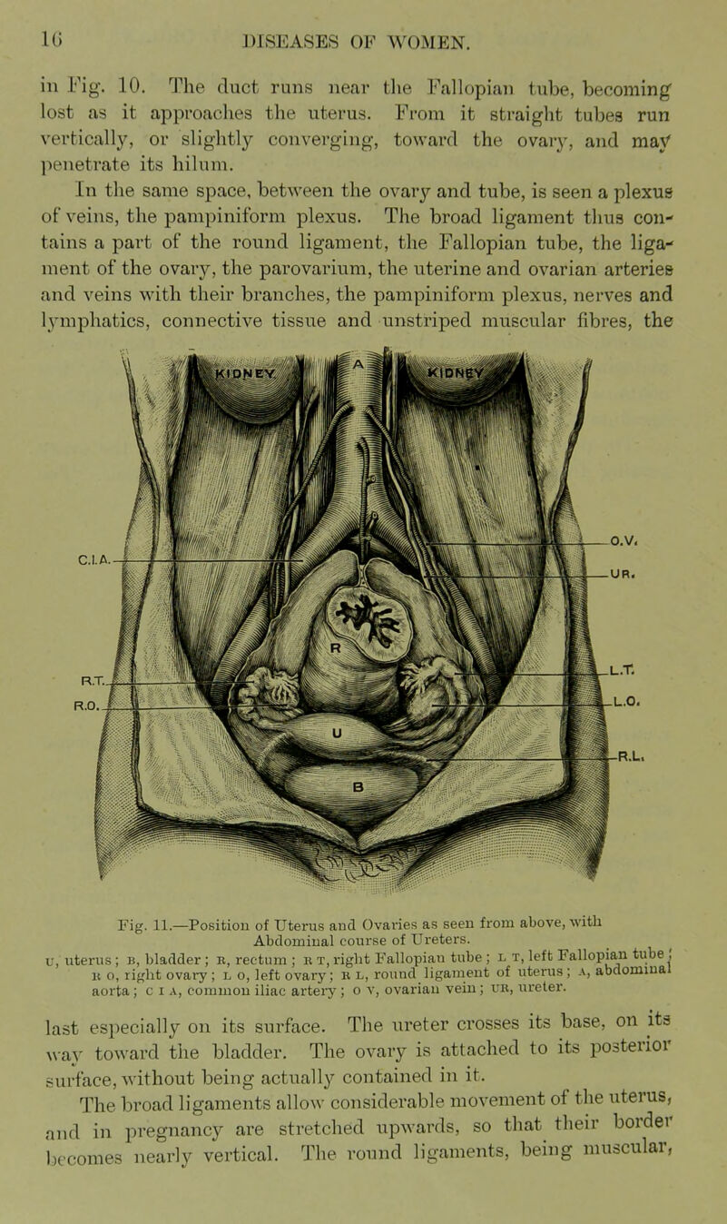 in Fig. 10. The duct runs near the Fallopian tube, becoming' lost as it approaches the uterus. From it straight tubes run vertically, or slightly converging, toward the ovary, and maV penetrate its hilum. In the same space, between the ovary and tube, is seen a plexus of veins, the pampiniform plexus. The broad ligament thus con- tains a part of the round ligament, the Fallopian tube, the liga- ment of the ovary, the parovarium, the uterine and ovarian arteries and veins with their branches, the pampiniform plexus, nerves and lymphatics, connective tissue and unstriped muscular fibres, the C.I. A. R.U. Fig. 11.—Position of Uterus and Ovaries as seen from above, with Abdominal course of Ureters, u, uterus; b, bladder; b, rectum ; b t, right Fallopian tube; l t, left Fallopian tube ; K o, right ovary; l o, left ovary; b l, round ligament of uterus; a, abdominal aorta; c i a, common iliac artery; o v, ovarian vein; ub, ureter. last especially on its surface. The ureter crosses its base, on its way toward the bladder. The ovary is attached to its posterior surface, without being actually contained in it. The broad ligaments allow considerable movement of the uterus, and in pregnancy are stretched upwards, so that their border becomes nearly vertical. The round ligaments, being muscular,