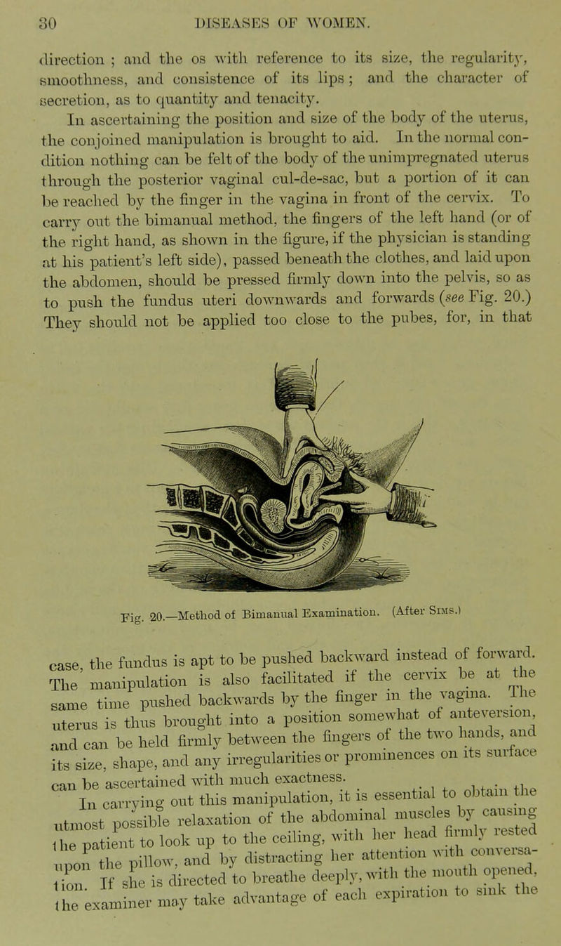 direction ; and the os with reference to its size, the regularity, smoothness, and consistence of its lips; and the character of secretion, as to quantity and tenacity. In ascertaining the position and size of the body of the uterus, the conjoined manipulation is brought to aid. In the normal con- dition nothing can be felt of the body of the unimpregnated uterus through the posterior vaginal cul-de-sac, but a portion of it can be reached by the finger in the vagina in front of the cervix. To carry out the bimanual method, the fingers of the left hand (or of the right hand, as shown in the figure, if the physician is standing at his patient's left side), passed beneath the clothes, and laid upon the abdomen, should be pressed firmly down into the pelvis, so as to push the fundus uteri downwards and forwards (see Fig. 20.) They should not be applied too close to the pubes, for, in that Fig. 20.—Method of Bimamml Examination. (After Sims.) case the fundus is apt to be pushed backward instead of forward. The' manipulation is also facilitated if the cervix be at the same time pushed backwards by the finger m the vagina. The uterus is thus brought into a position somewhat of anteversion and can be held firmly between the fingers of the two hands, and its size, shape, and any irregularities or prominences on its surface can be ascertained with much exactness. i, • .i In carrying out this manipulation, it is essential to obtam the utmost possibi relaxation of the abdominal --^^s by ^^^^^^^^^ the patient to look up to the ceiling, with her head fiimlj lested northe pillow, and by distracting her attention with conversa- r I sh is directed to breathe deeply, with the mouth opened he examiner may take advantage of each expiration to sink the