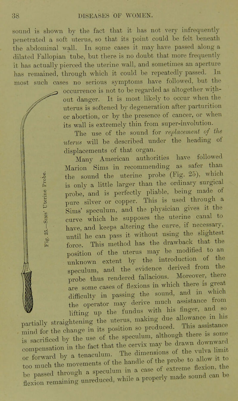 sound is shown by tlie fact that it has not very infrequently penetrated a soft uterus, so that its point could be felt beneath the abdominal wall. In sqnie cases it may have passed along a dilated Fallopian tube, but there is no doubt that more frequently it has actually pierced the uterine wall, and sometimes an aperture has remained, through which it could be repeatedly passed. In most such cases no serious symptoms have followed, but the occurrence is not to be regarded as altogether with- out danger. It is most likely to occur when the uterus is softened by degeneration after parturition or abortion, or by the presence of cancer, or when its wall is extremely thin from super-involution. The use of the sound for replacement of the uterus will be described under the heading of displacements of that organ. Many American authorities have followed Marion Sims in recommending as safer than the sound the uterine probe (Fig. 25), which is only a little larger than the ordinary surgical probe, and is perfectly pliable, being made of pure silver or copper. This is used through a Sims' speculum, and the physician gives it the curve which he supposes the uterine canal to have, and keeps altering the curve, if necessary, until he can pass it without using the slightest force. This method has the drawback that the position of the uterus may be modified to an unknown extent by the introduction of the speculum, and the evidence derived from the probe thus rendered fallacious. Moreover, there are some cases of flexions in which there is great difficulty in passing the sound, and m winch the operator may derive much assistance from lifting up the fundus with his finger, and so partially straightening the uterus, making due ^^J^^ o u .a o -is .(-4