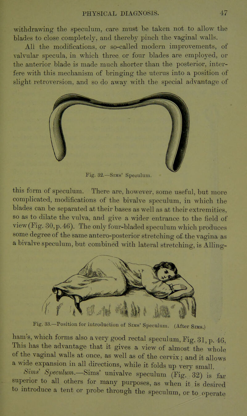 Avithdrawing the speculum, care must be taken not to allow the blades to close completely, and thereby pinch the vaginal walls. All the modifications, or so-called modern improvements, of valvular specula, in which three or four blades are employed, or the anterior blade is made much shorter than the posterior, inter- fere with this mechanism of bringing the uterus into a position of slight retroversion, and so do away with the special advantage of Fig. 32.—Sims' Speuulum. this form of speculum. There are, however, some useful, but more complicated, modifications of the bivalve speculum, in which the blades can be separated at their bases as well as at their extremities, so as to dilate the vulva, and give a wider entrance to the field of view (Fig. 30, p. 46). The only four-bladed speculum which produces some degree of the same antero-posterior stretching of the vagina as a bivalve speculum, but combined with lateral stretching, is Ailing- Fig. 33.—Position for introduction of Sims' Speculum. (After Sims.) ham's, which forms also a very good rectal speculum. Fig. 31, p. 4G. This has the advantage that it gives a view of almost the whole of the vaginal walls at once, as well as of the cervix; and it allows a wide expansion in all directions, while it folds up very small. Sims' Speculum.—Sims' univalve speculum (Fig. 32) is far superior to all others for many purposes, as when it is desired to mtroduce a tent or probe through the speculum, or to operate