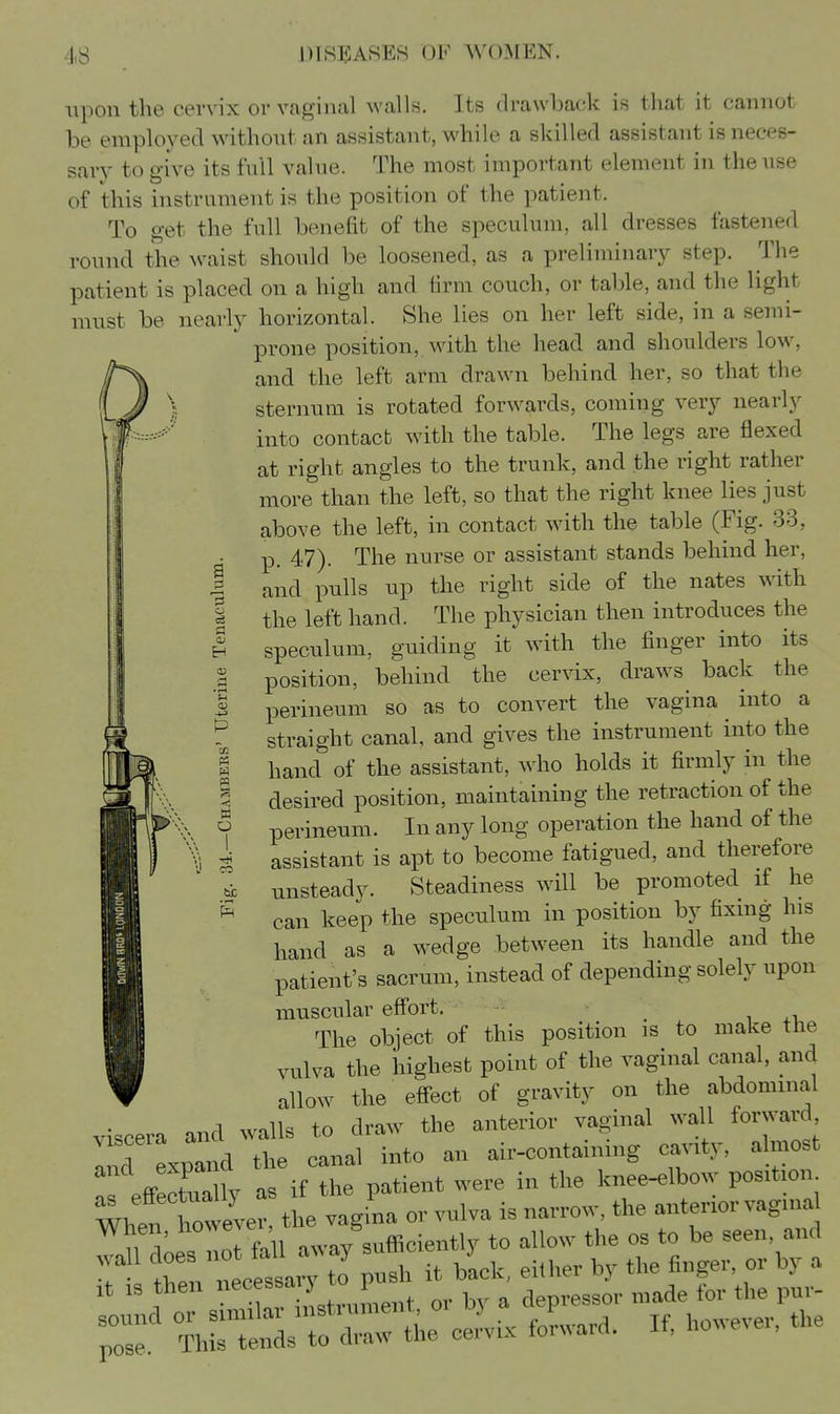 upon the cervix or vaginal walls. Its (lra\vT)a(!k is that it cannot be employed without an assistant, while a skilled assistant is neces- sary to give its full value. The most important element in the use of this instrument is the position of the patient. To get the full benefit of the speculum, all dresses fastened round the Avaist should be loosened, as a preliminary step. The patient is placed on a high and firm couch, or table, and the light must be nearly horizontal. She lies on her left side, in a semi- prone position, with the head and shoulders low, and the left arm drawn behind her, so that the sternum is rotated forwards, coming very nearly into contact with the table. The legs are flexed at right angles to the trunk, and the right rather more than the left, so that the right knee lies just above the left, in contact with the table (Fig. 33, p. 47). The nurse or assistant stands behind her, and pulls up the right side of the nates with the left hand. The physician then introduces the speculum, guiding it with the finger into its position, behind the cervix, draws back the perineum so as to convert the vagina into a straight canal, and gives the instrument into the hand of the assistant, who holds it firmly in the desired position, maintaining the retraction of the perineum. In any long operation the hand of the assistant is apt to become fatigued, and therefore unsteady. Steadiness will be promoted if he can keep the speculum in position by fixing his hand as a wedge between its handle and the patient's sacrum, instead of depending solely upon muscular effort. - - HI The object of this position is to make the H vulva the highest point of the vaginal canal, and ▼ allow the efi-ect of gravity on the abdommal viscera and w.alls to draw the anterior vaginal wall forward and expand the canal into an air-containmg cju.ty, almost pffppluaUv as if the patient were in the knee-elbow position WhefroweCt^^^ vagina or vulva is narrow, the anterior vaginal When, howev , J^ . ^How the os to be seen, and ■I ^r.lessa^ P-h it back, either by the finger, or by a xt IS then ,r 1 , depressor made for the pur- IZ the cervix foLard. If, however, the a CO p? s o be