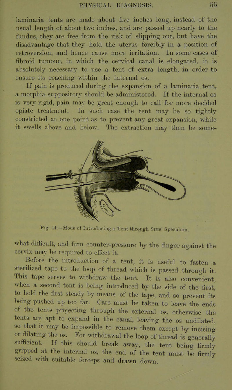 laminaria tents are made about five inches long, instead of the usual length of about two inches, and are passed up nearly to the fundus, they are free from the risk of slipping out, but have the disadvantage that they hold the uterus forcibly in a position of retroversion, and hence cause more irritation. In some cases of fibroid tumour, in which the cervical canal is elongated, it is absolutely necessary to use a tent of extra length, in order to ensure its reaching within the internal os. If pain is produced during the expansion of a laminaria tent, a morphia suppository should be administered. If the internal os is very rigid, pain may be great enough to call for more decided opiate treatment. In such case the tent may be so tightly constricted at one point as to prevent any great expansion, while it swells above and below. The extraction may then be some- Fig. 44.—Mode of Introducing a Tent through Sims' Speculum. what difficult, and firm counter-pressure by the finger against the cervix may be required to effect it. Before the introduction of a tent, it is useful to fasten a sterilized tape to the loop of thread wliich is passed through it. This tape serves to withdraw the tent. It is also convenient, when a second tent is being introduced by the side of the first, to hold the first steady by means of the tape, and so prevent its being pushed up too far. Care must be taken to leave the ends of the tents projecting through the external os, otherwise the tents are apt to expand in the canal, leaving the os undilated, so that it may be impossible to remove them except by incising or dilating the os. For withdrawal the loop of thread is generally sufficient. If this should break away, the tent being firmly gripped at the internal os, the end of the tent must be firmly seized with suitable forceps and drawn down.