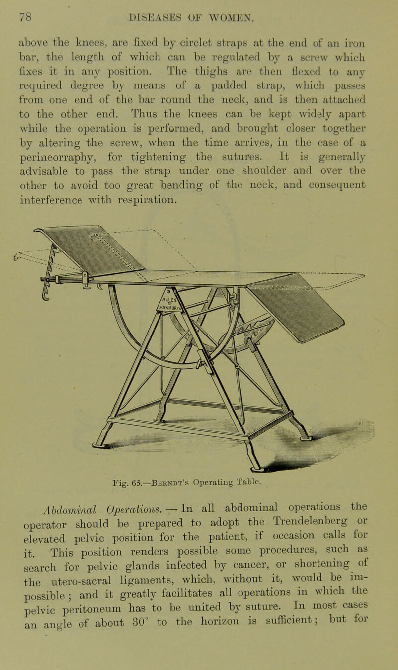 above the knees, are fixed by circlet straps at the end of an iron bar, the length of which can be regulated by a screw which fixes it in any position. The thighs are then flexed to any required degree by means of a padded strap, which passes from one end of the bar round the neck, and is then attached to the other end. Thus the knees can be kept widely apart while the operation is performed, and brought closer together by altering the screw, when the time arriv.es, in the case of a perineorraphy, for tightening the sutures. It is generally advisable to pass the strap under one shoulder and over the other to avoid too great bending of the neck, and consequent interference with respiration. Abdominal Operations. — In all abdominal operations the operator should be prepared to adopt the Trendelenberg or elevated pelvic position for the patient, if occasion calls for it. This position renders possible some procedures, such as search for pelvic glands infected by cancer, or shortening of the utero-sacral ligaments, which, without it, would be im- possible ; and it greatly facilitates all operations in which the pelvic peritoneum has to be united by suture. In most cases an angle of about 30° to the horizon is sufficient; but for